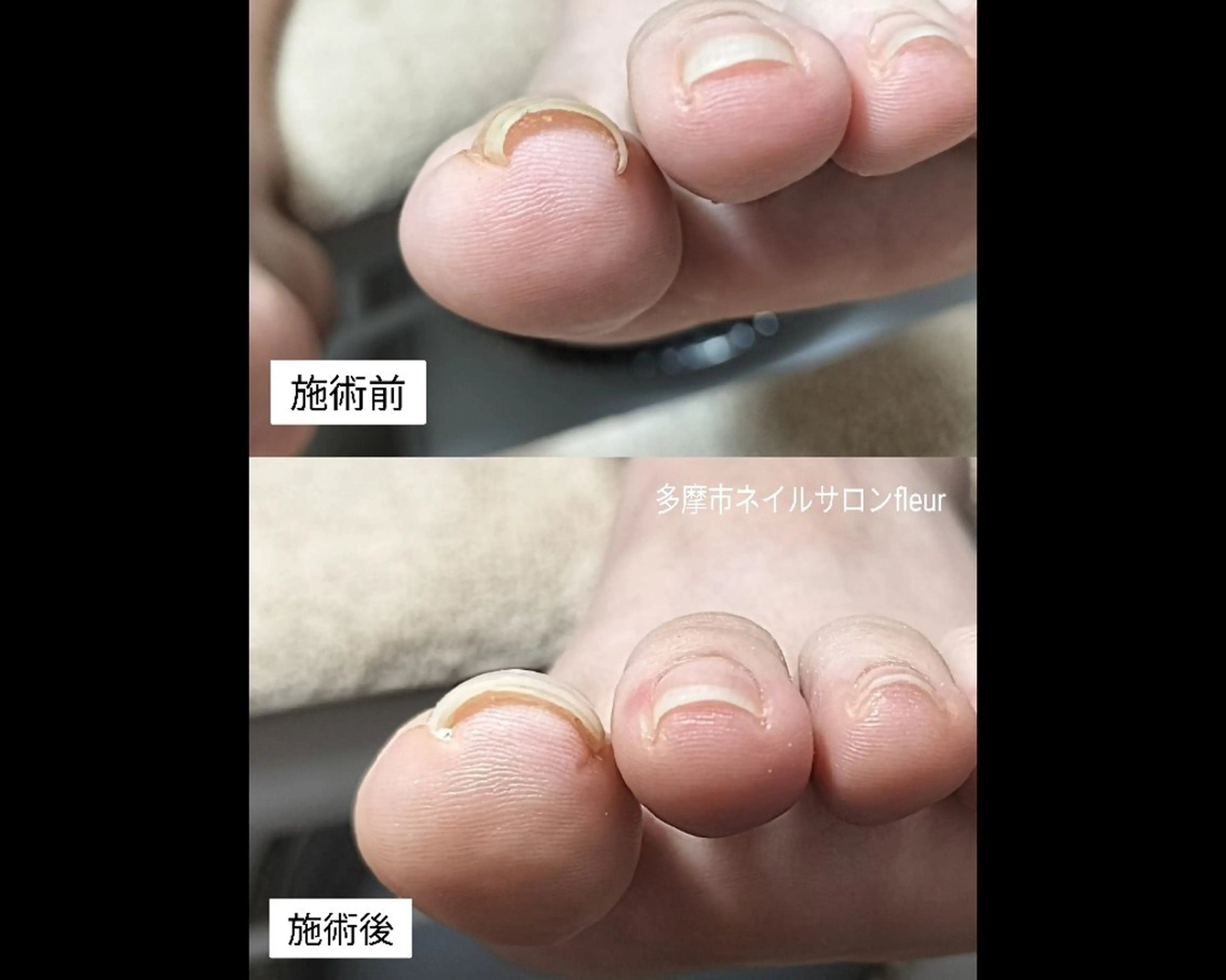 ネイル クリアネイル フットネイル ワンカラーネイル megumi. sのネイルデザイン