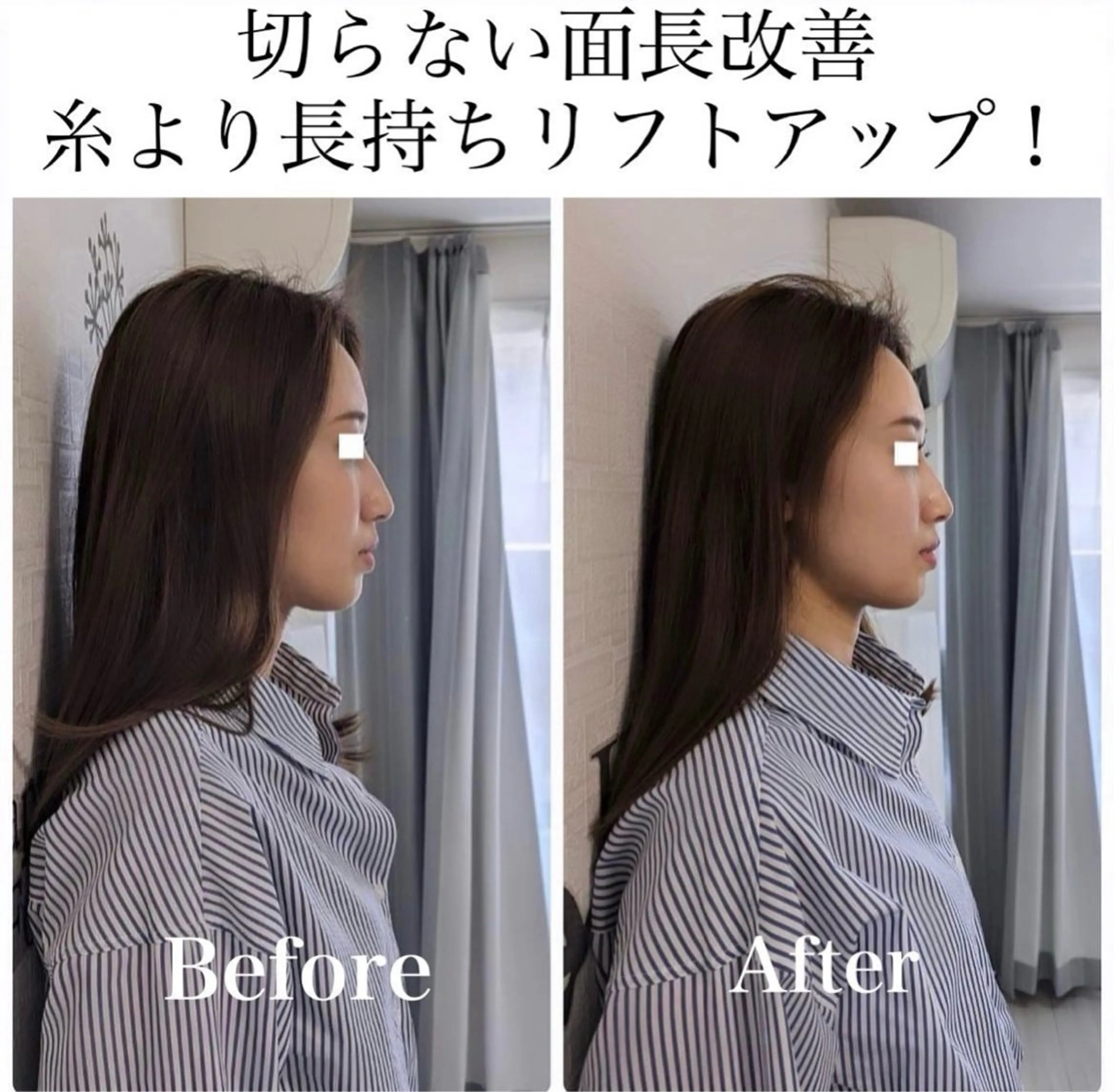 La　Beaute Verite所属・浅居 結菜のその他イメージ