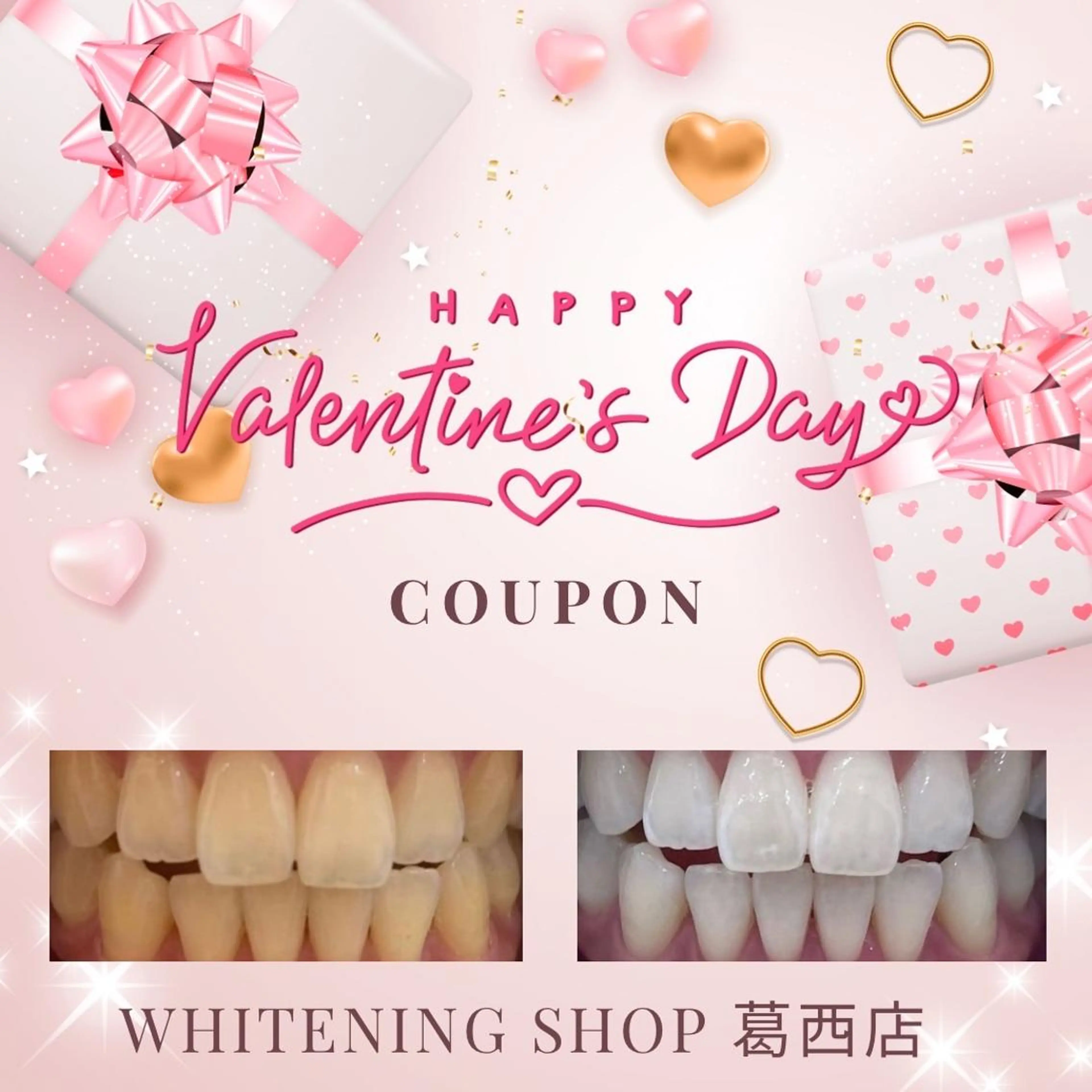 メンズ その他 ホワイトニング ショップ葛西店のその他イメージ