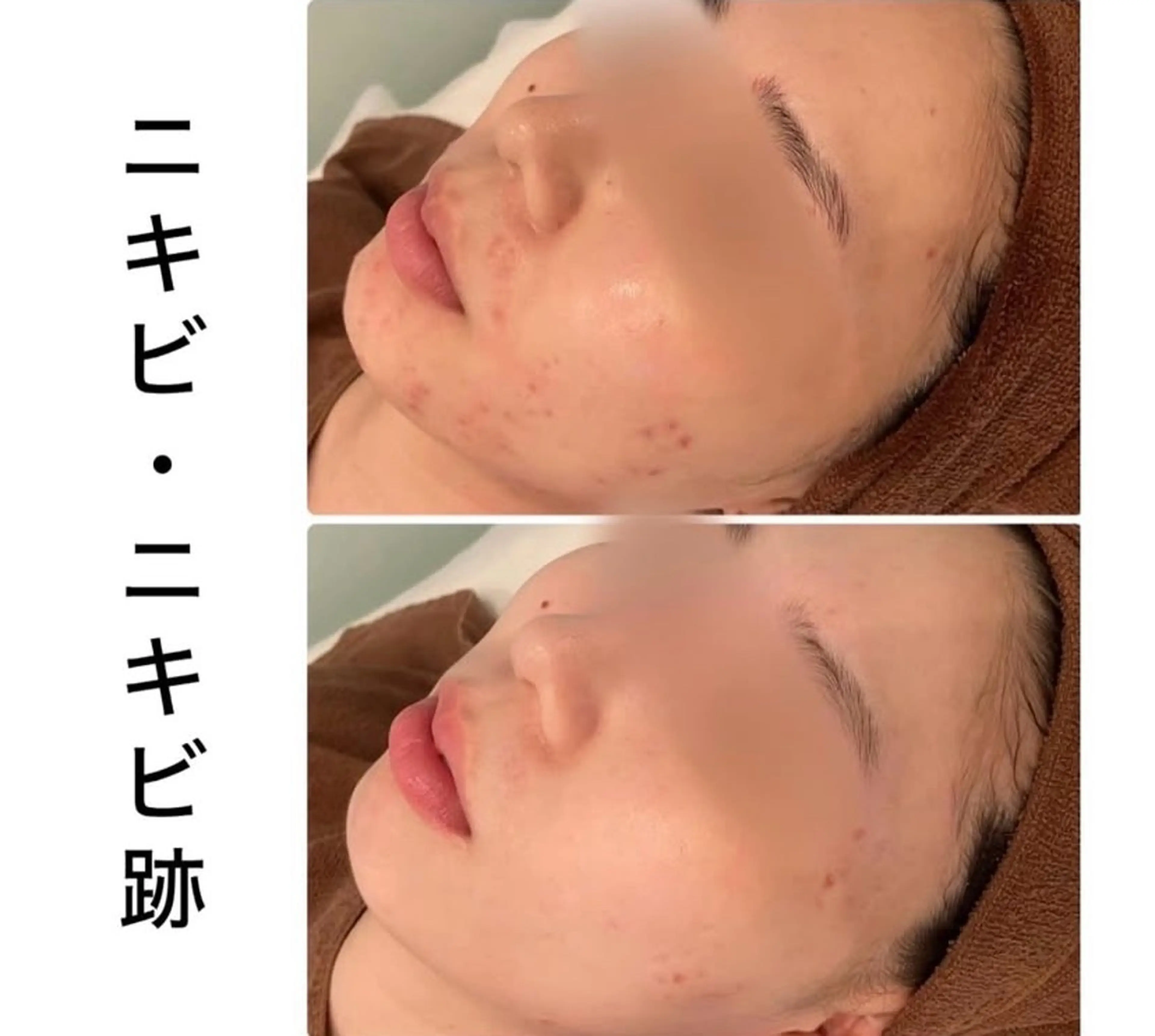 その他 Bioplus +  ビオプラス川崎所属・ハーブピーリング専門 BIOPLUS＋川崎のエステ・リラクイメージ