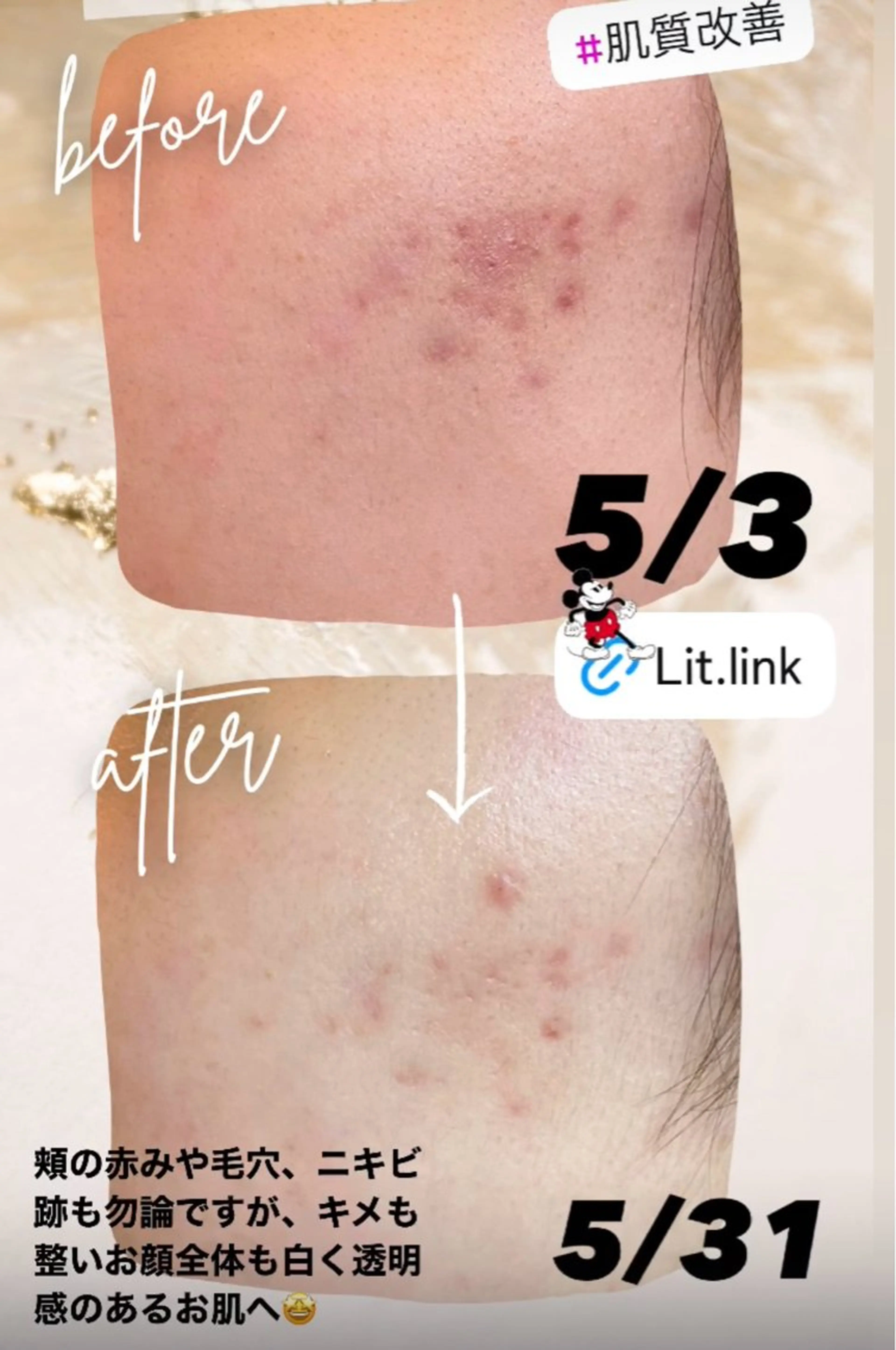 Nao Fukuoka/healingforceN所属・野中 康子のエステ・リラクイメージ