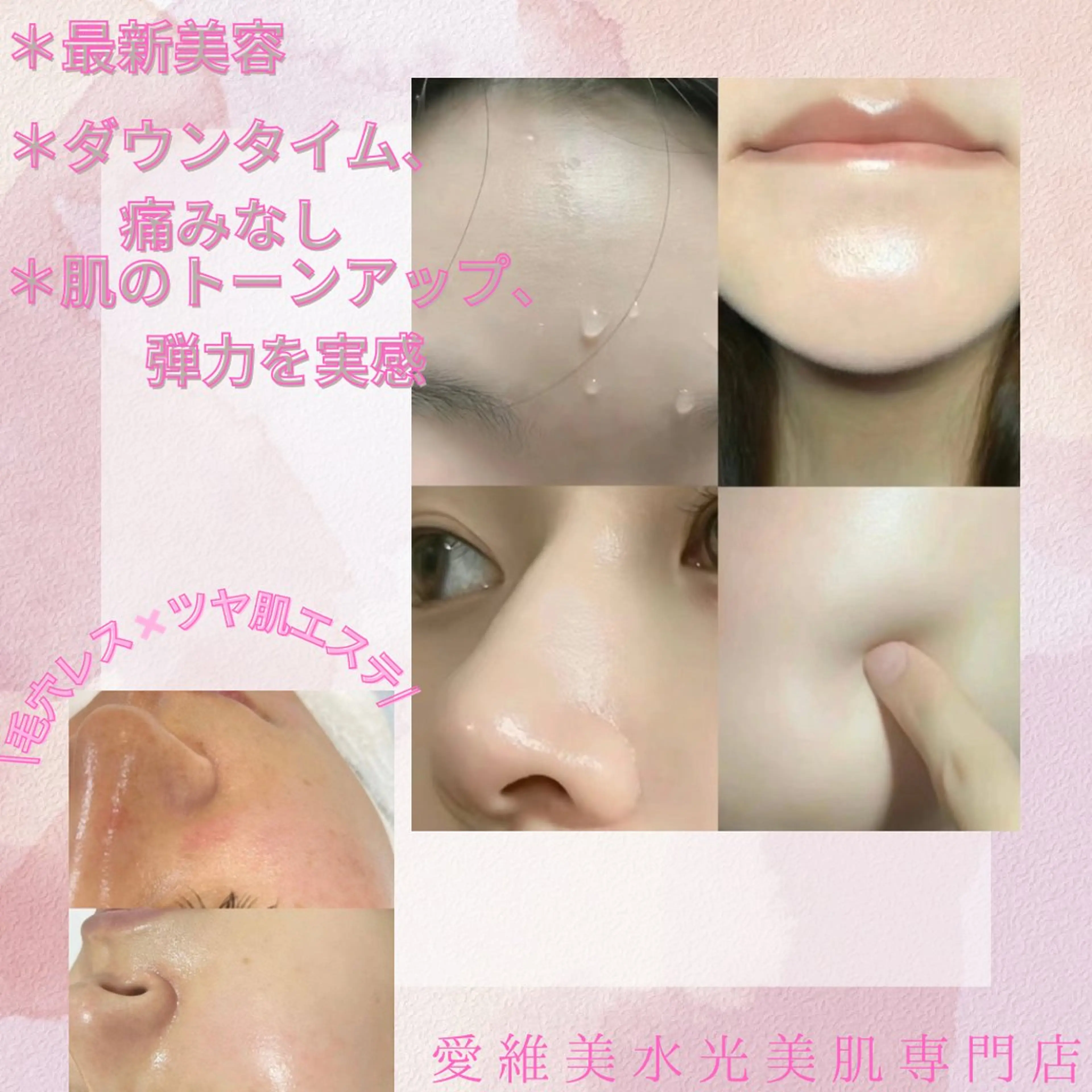 エステ リラク 愛維美水光美肌専門店所属・愛維美水光美肌専門店 メンズレディースokのエステ・リラクイメージ