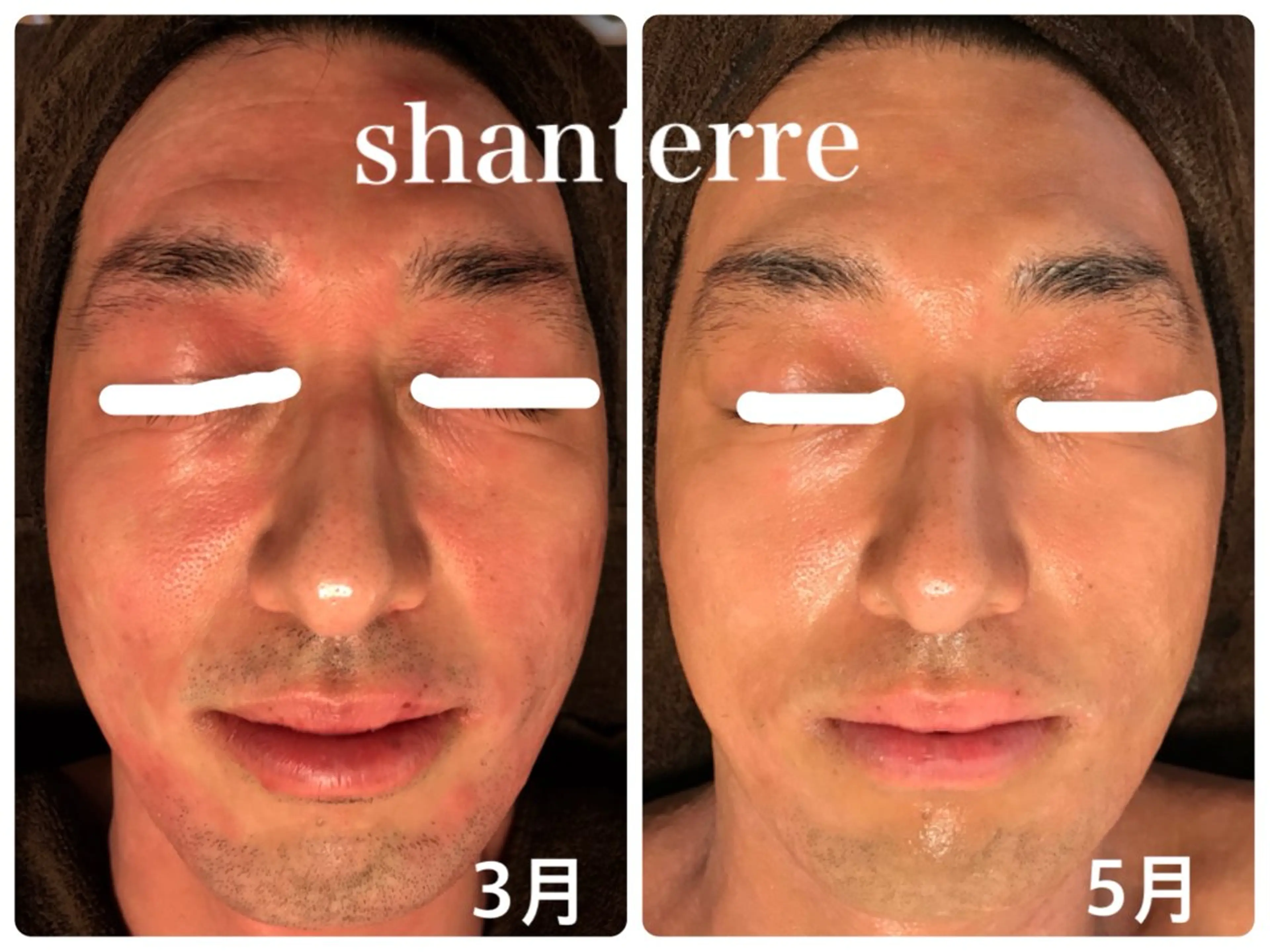 ピーリングサロン シャンテール所属・ピーリングサロン シャンテールのエステ・リラクイメージ