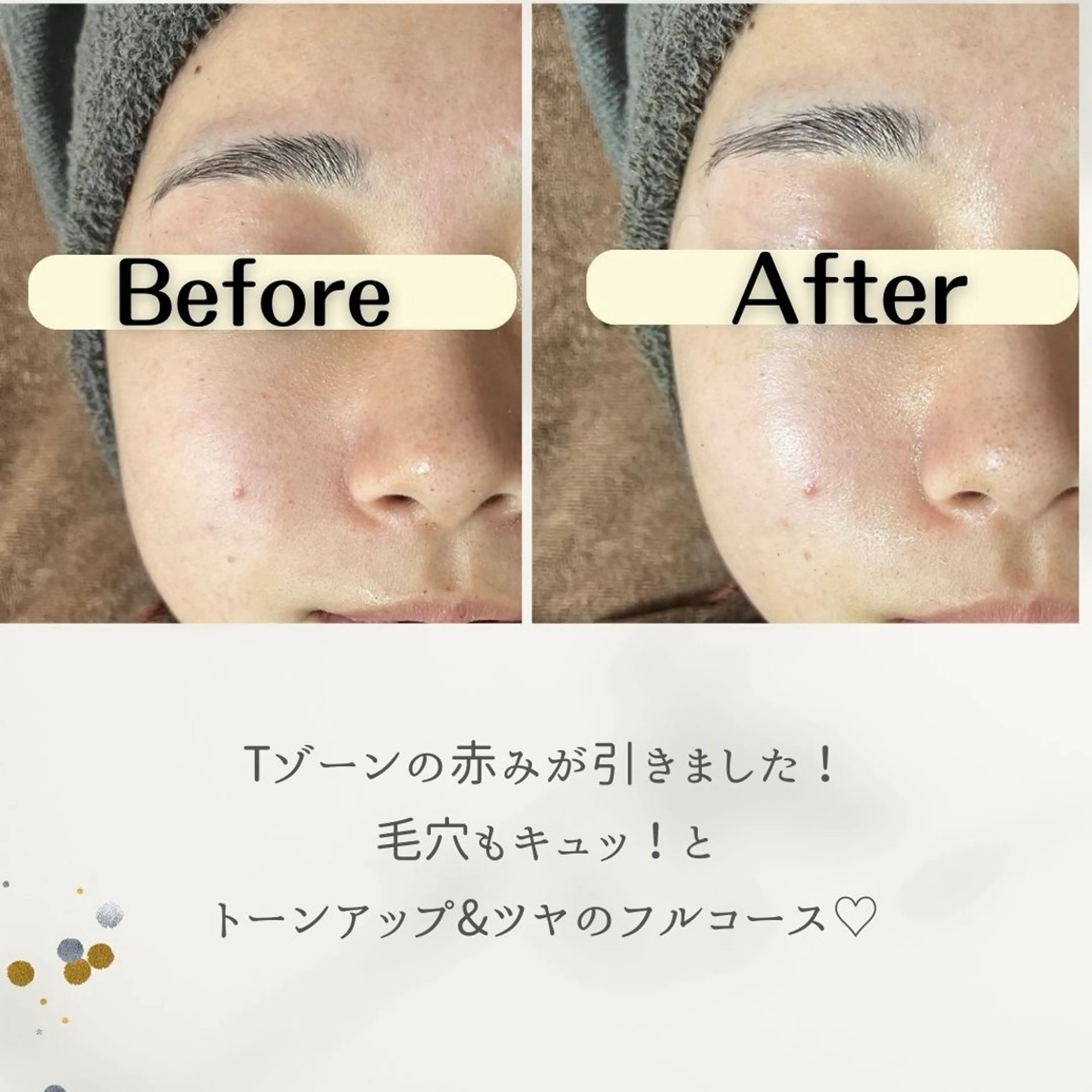 お肌と歯のサロン　Sona Mior所属・藤井 ののみのその他イメージ
