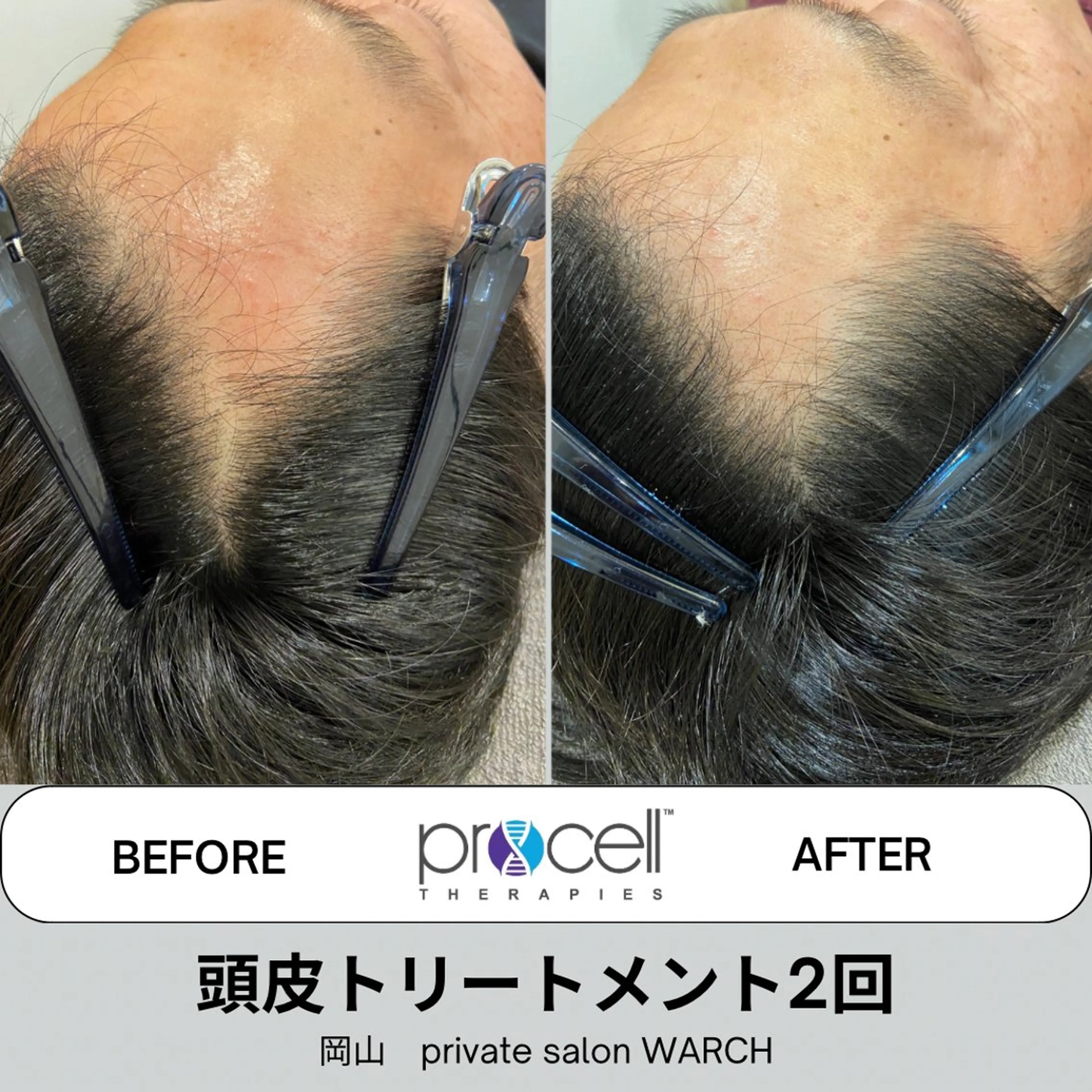 その他 WARCH Marieのエステ・リラクイメージ