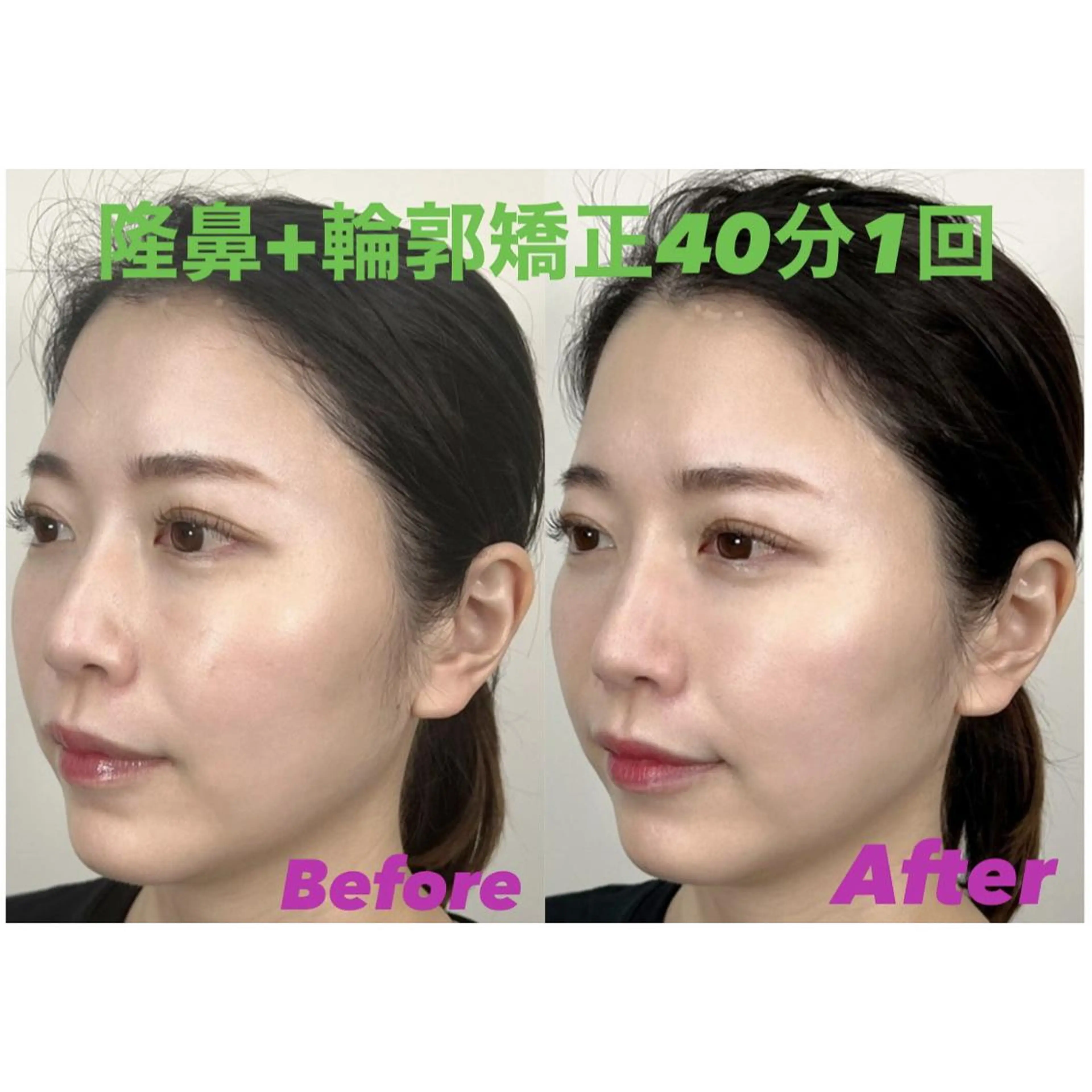 隆鼻矯正専門店ラプリ 加藤のエステ・リラクイメージ