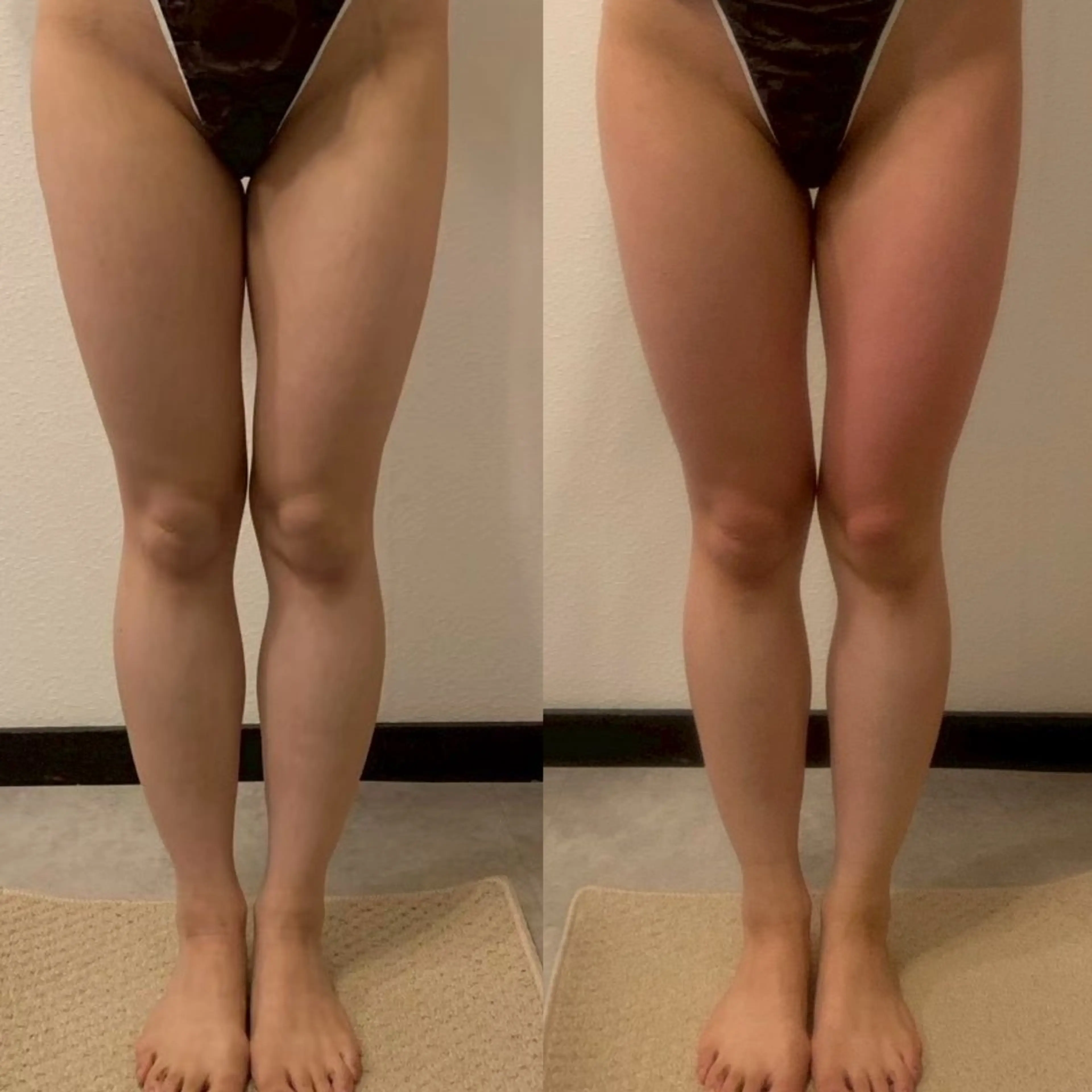 エステ 痩身専門店 GRANDIRのエステ・リラクイメージ