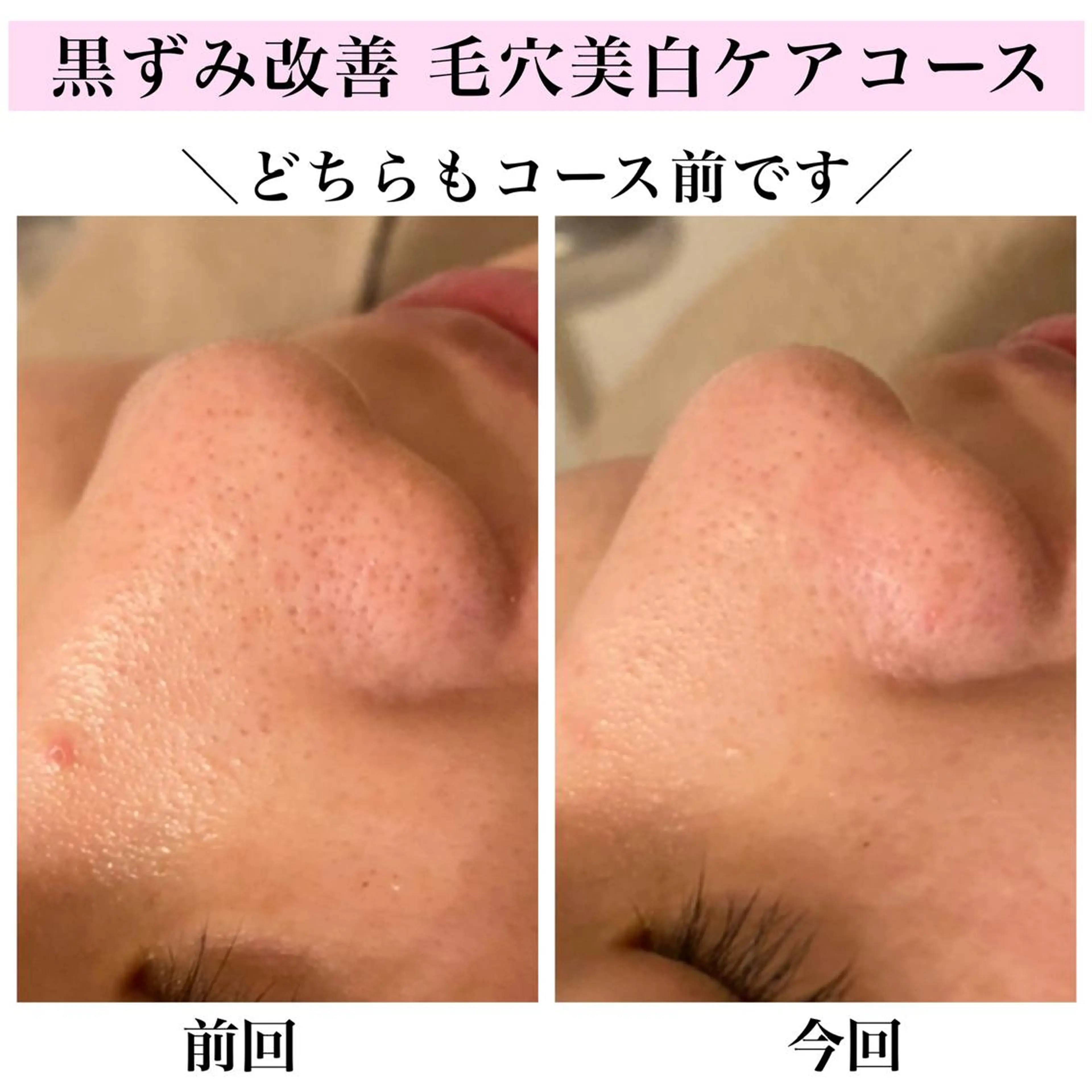 エステ リラク Bellesthe (ベルエステ)のエステ・リラクイメージ