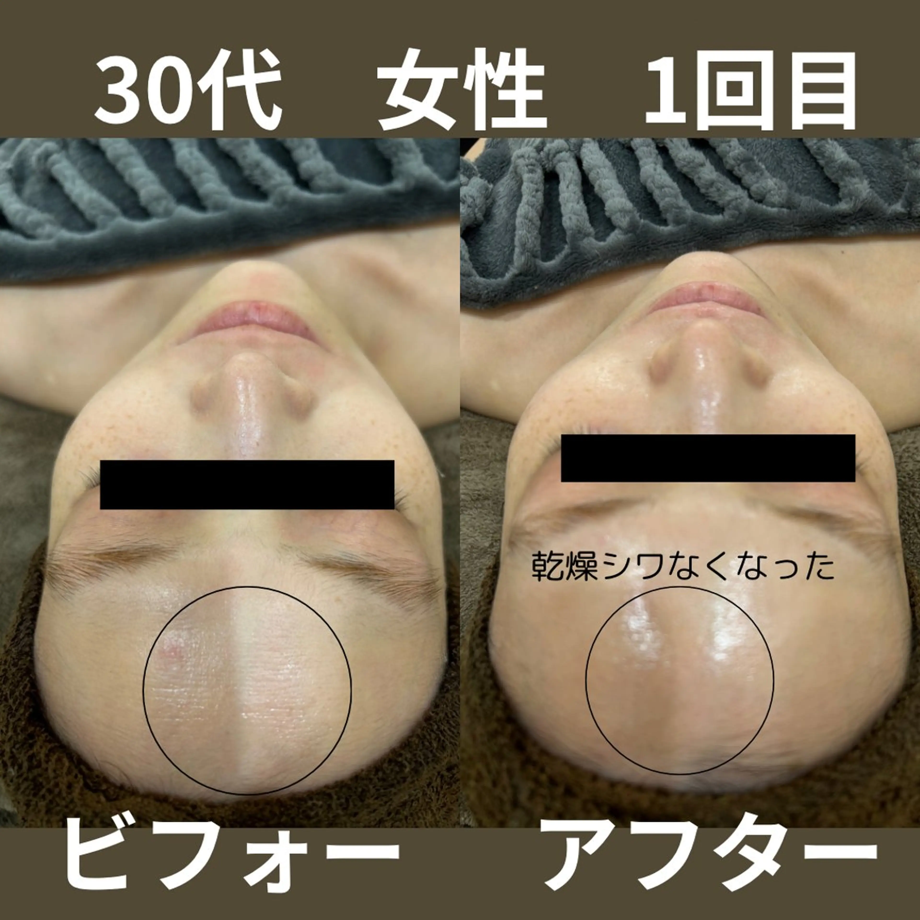 その他 NiU.BEAUTY🥥池袋店所属・ハーブピーリング専門 NiU.BEAUTYのエステ・リラクイメージ