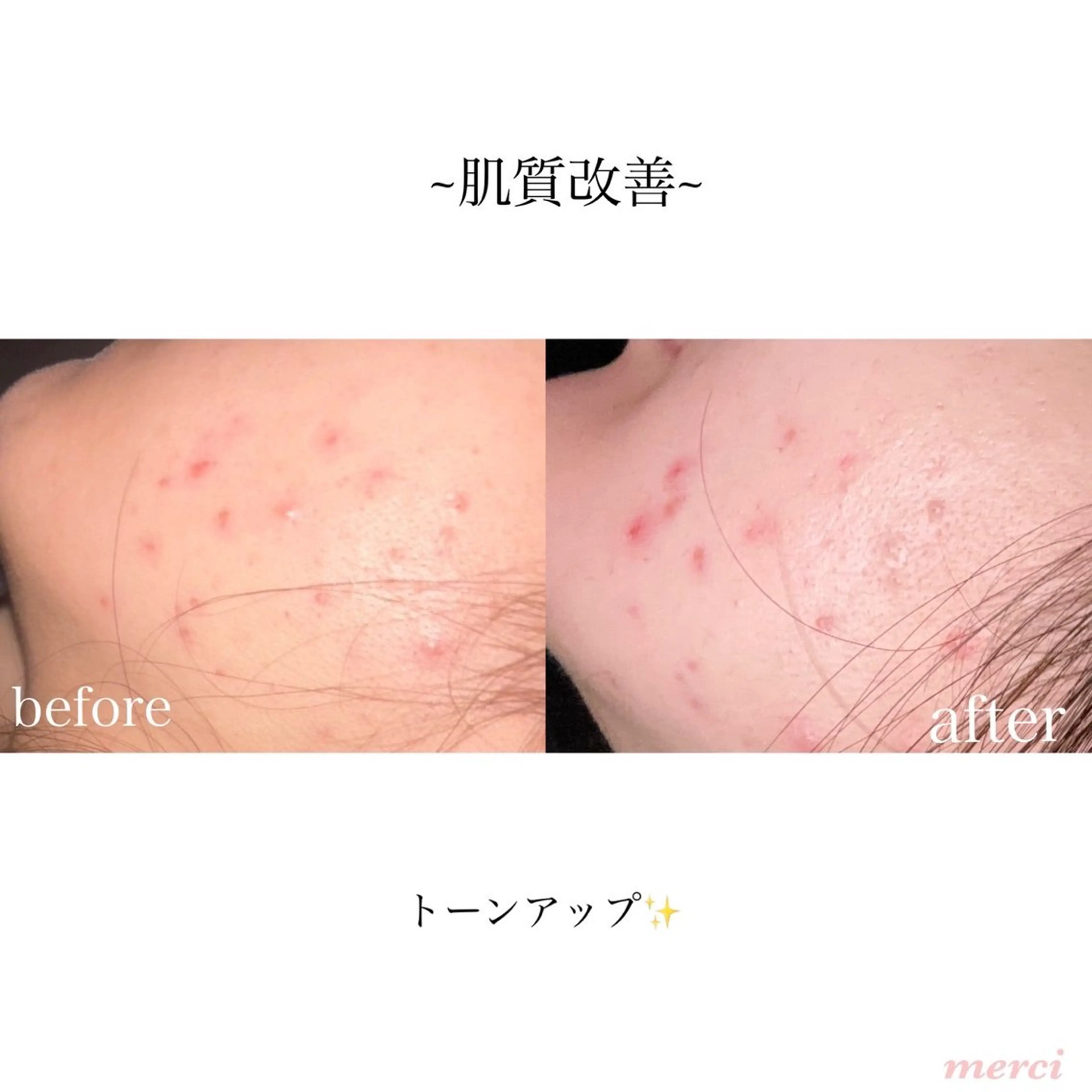 salon merciのエステ・リラクイメージ