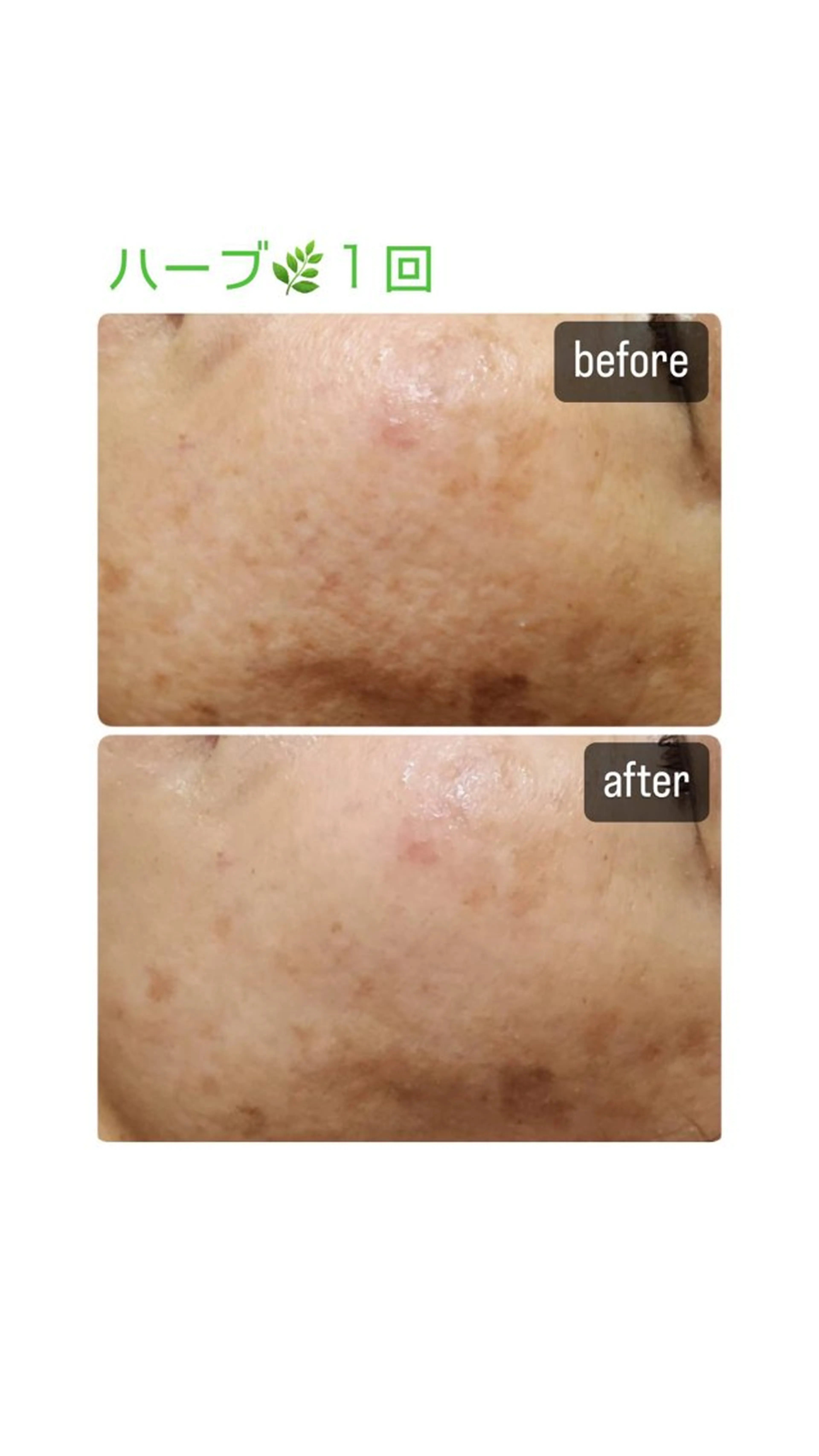 志免町 フェイスシャルエステのエステ・リラクイメージ