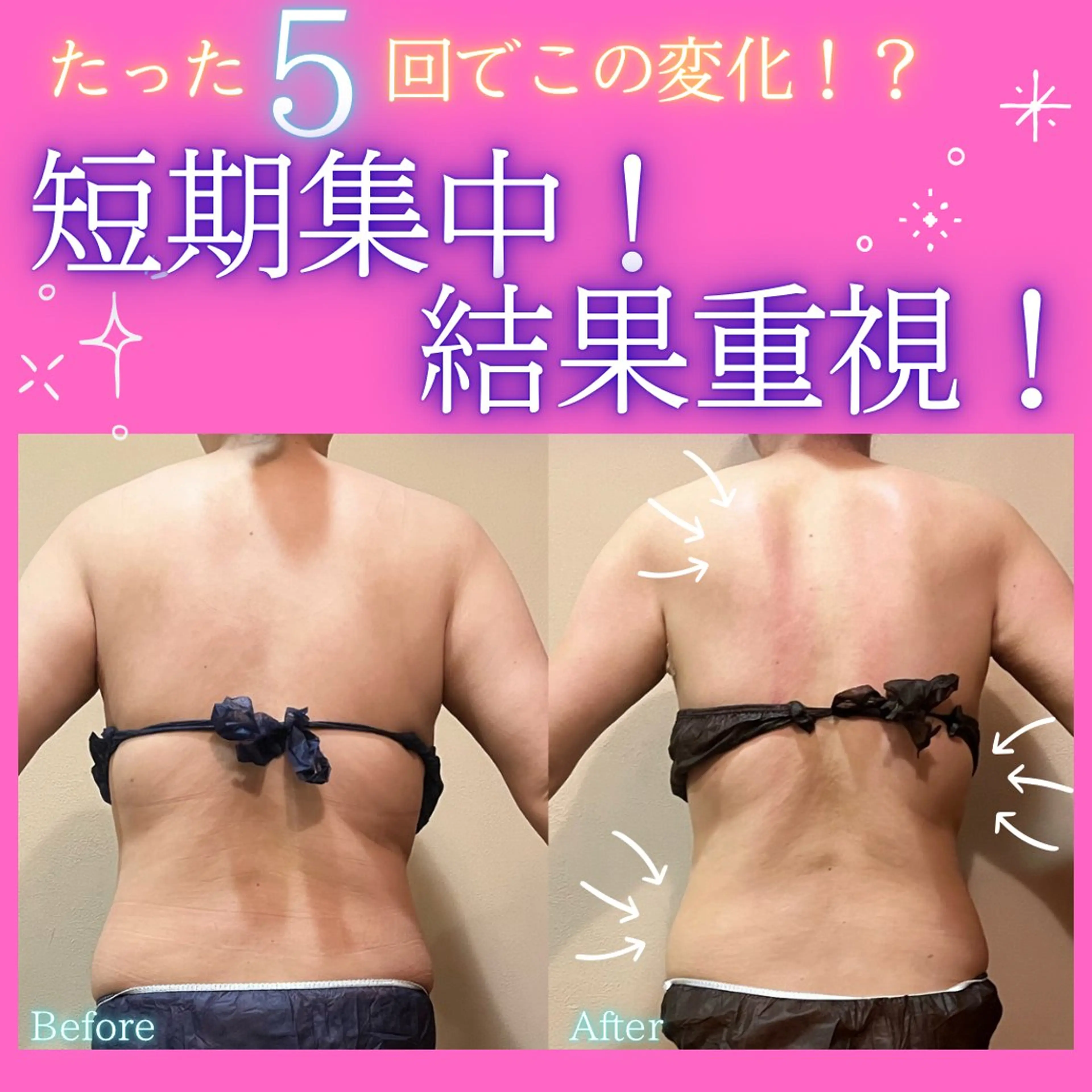 エステ 痩身&美肌サロン 堀米✨のエステ・リラクイメージ