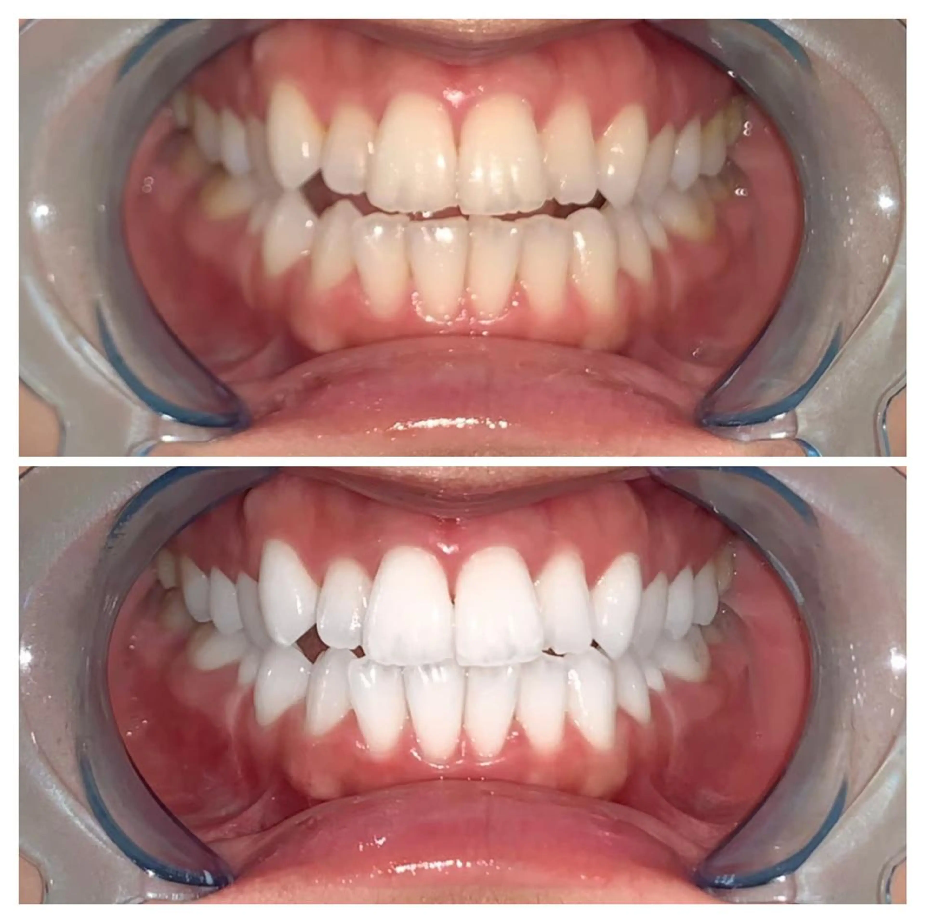 ロング ヘアアレンジ ネイル マツエク・マツパ メンズ カラー パーマ キッズ アイブロウ エステ リラク ライトビューティー 銀座店のエステ・リラクイメージ