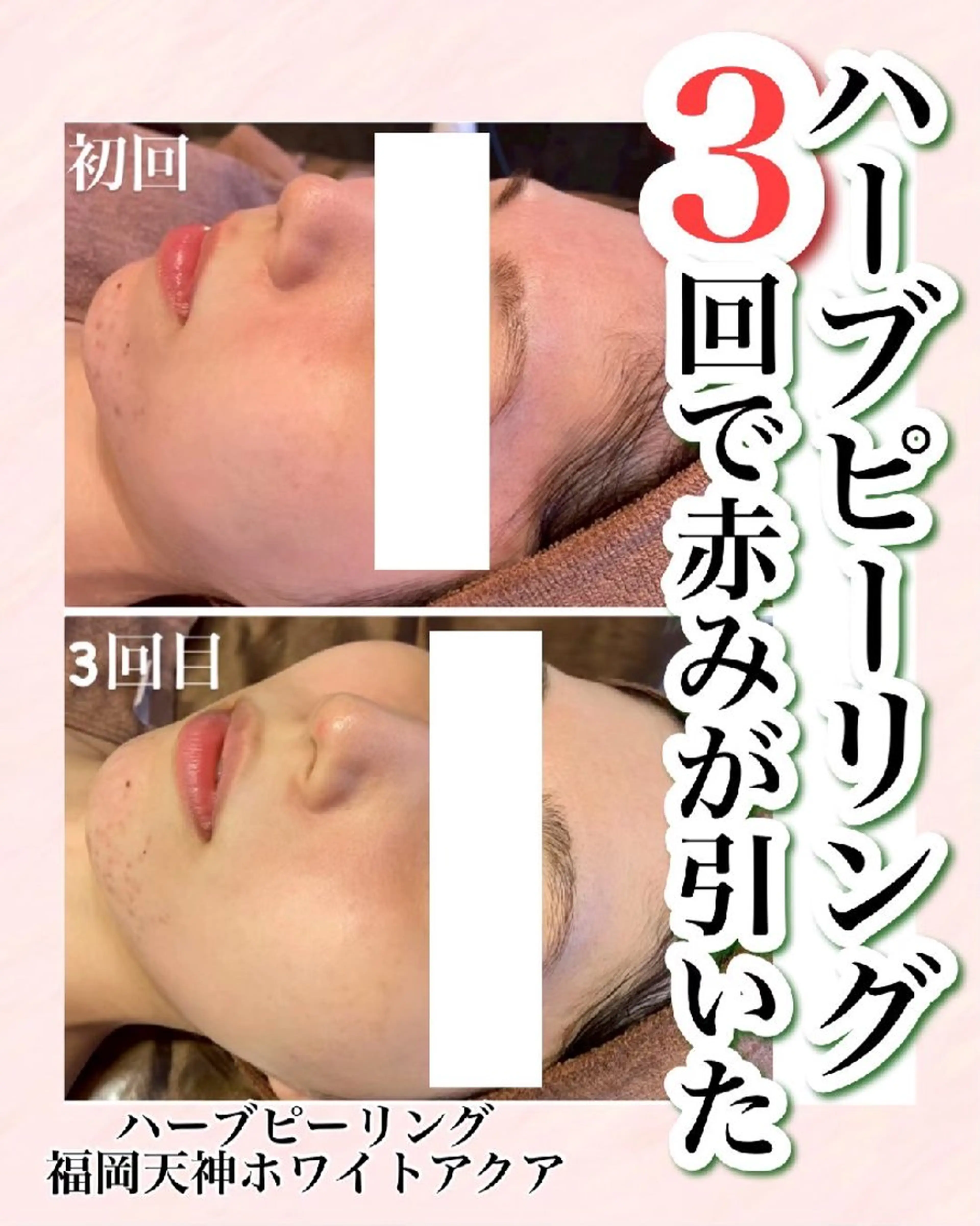 メンズ キッズ WHITEAQUA 福岡天神店のエステ・リラクイメージ