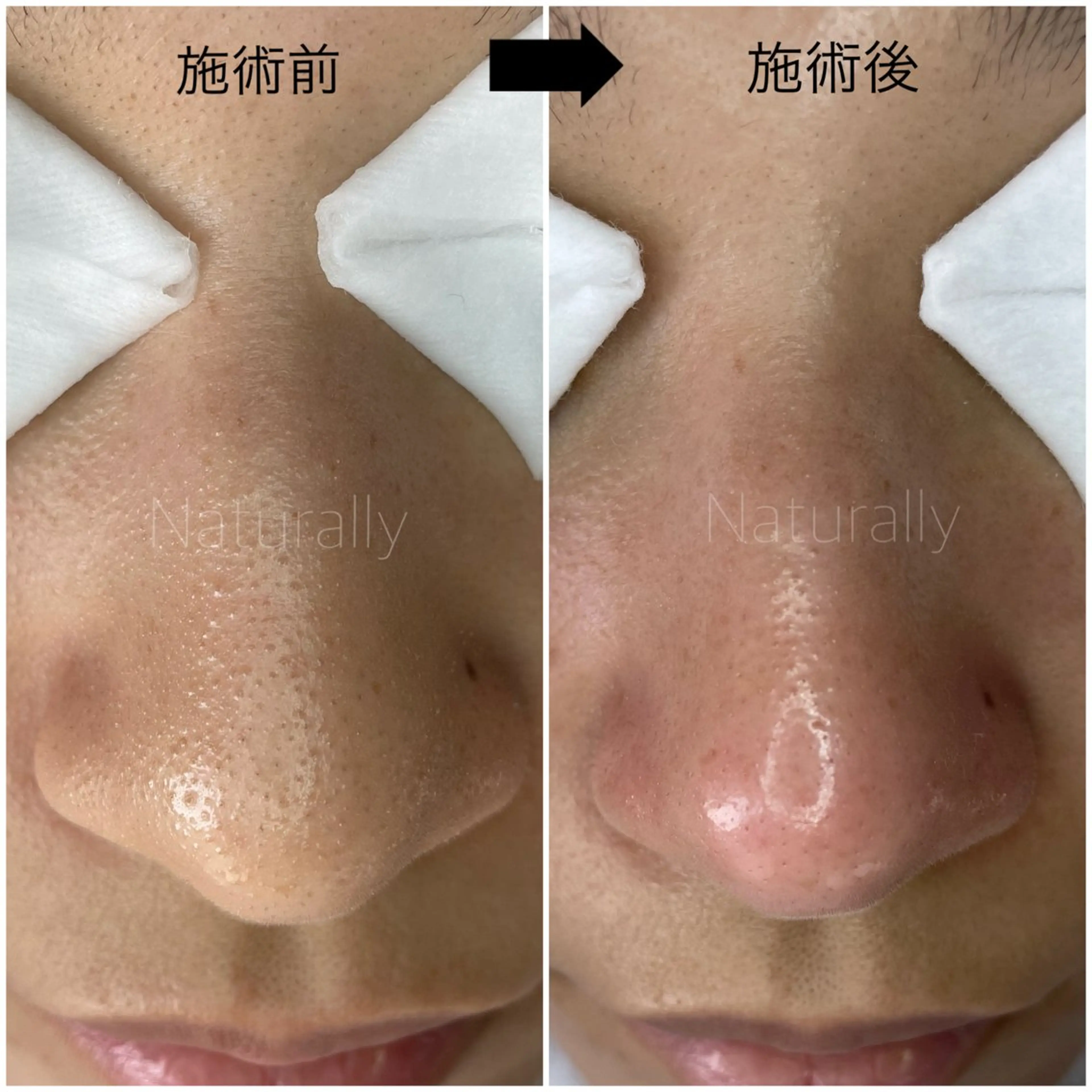 Naturally ナチュラリーのマツエク・マツパデザイン