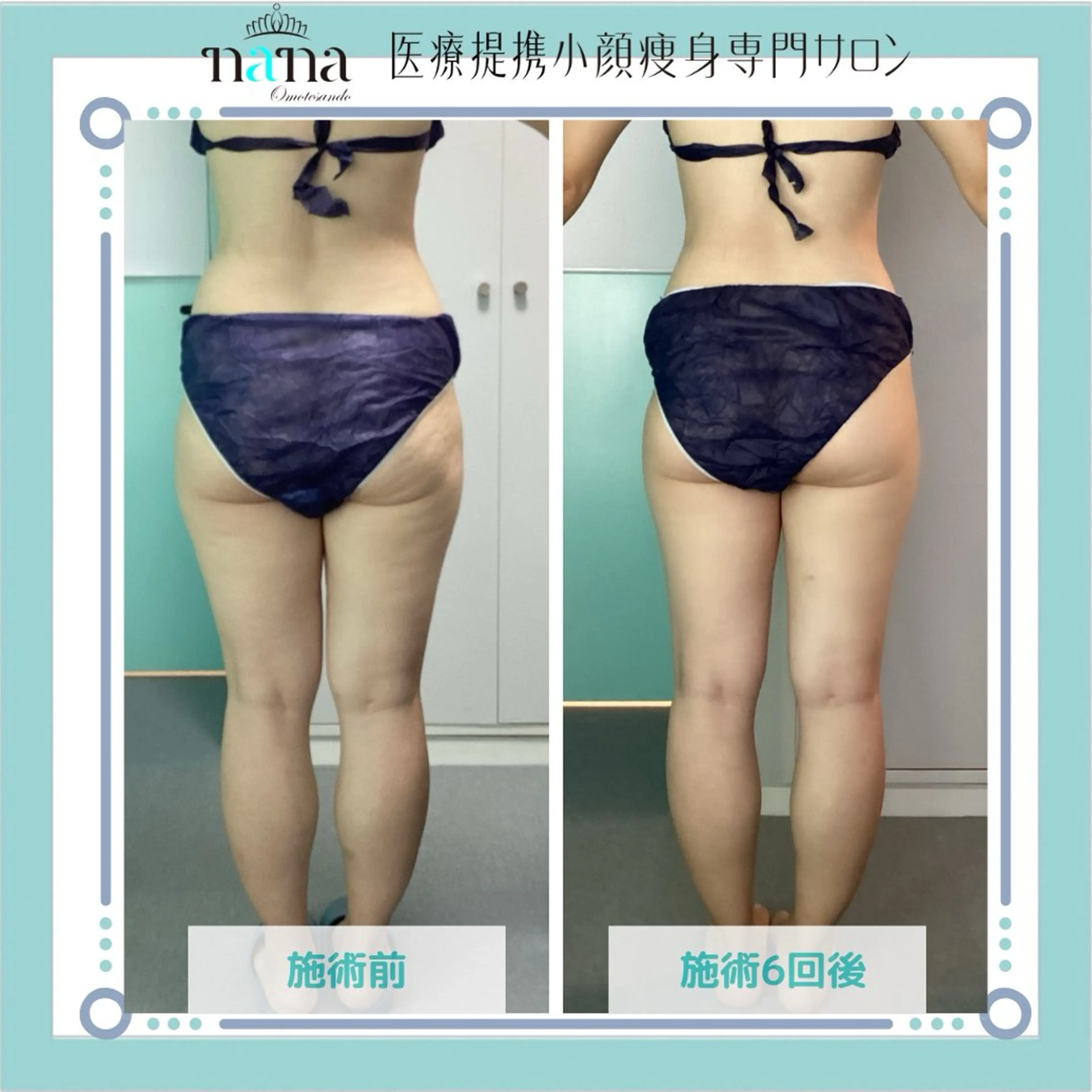 小顔痩身インディバ Nana表参道のエステ・リラクイメージ