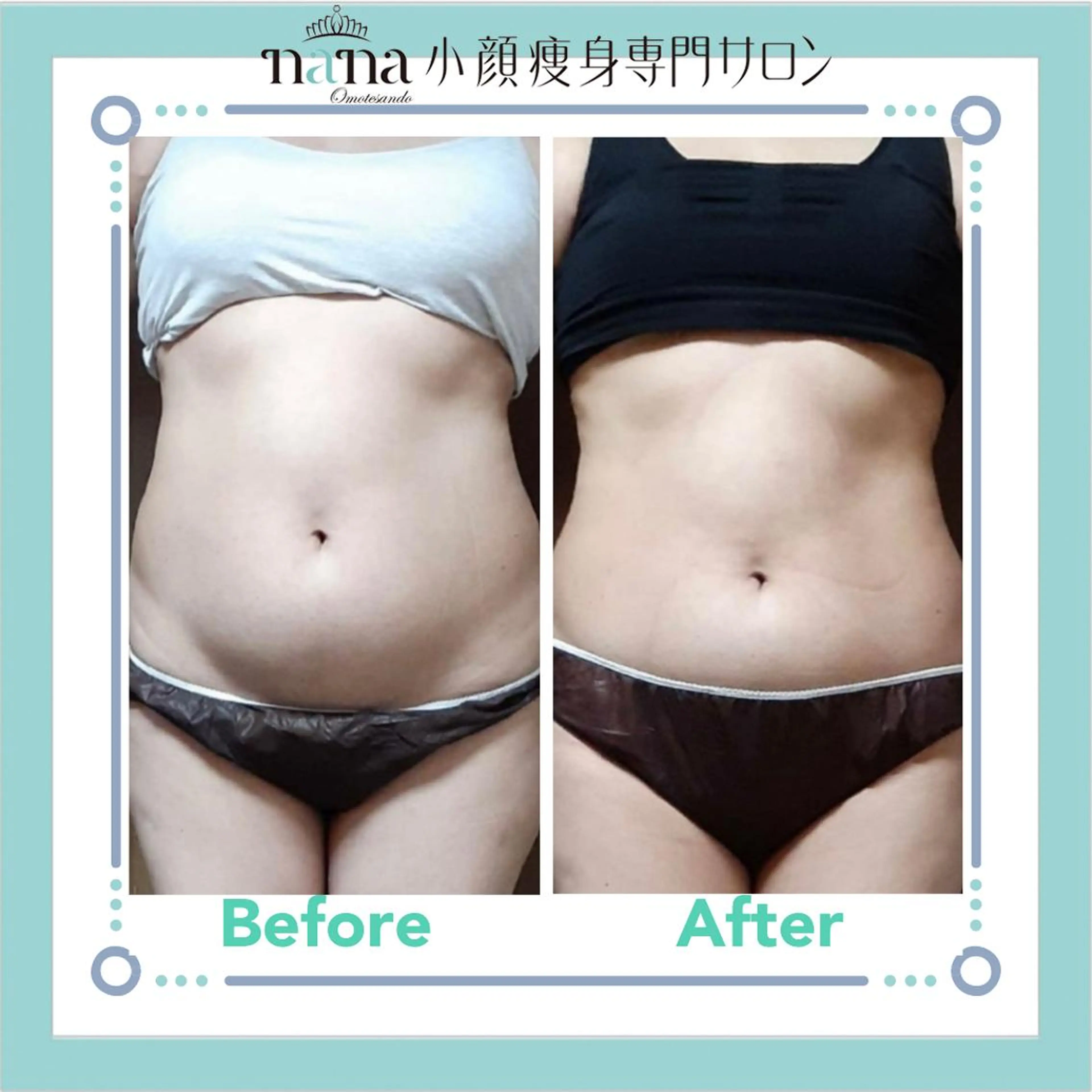 小顔痩身インディバ Nana表参道のエステ・リラクイメージ