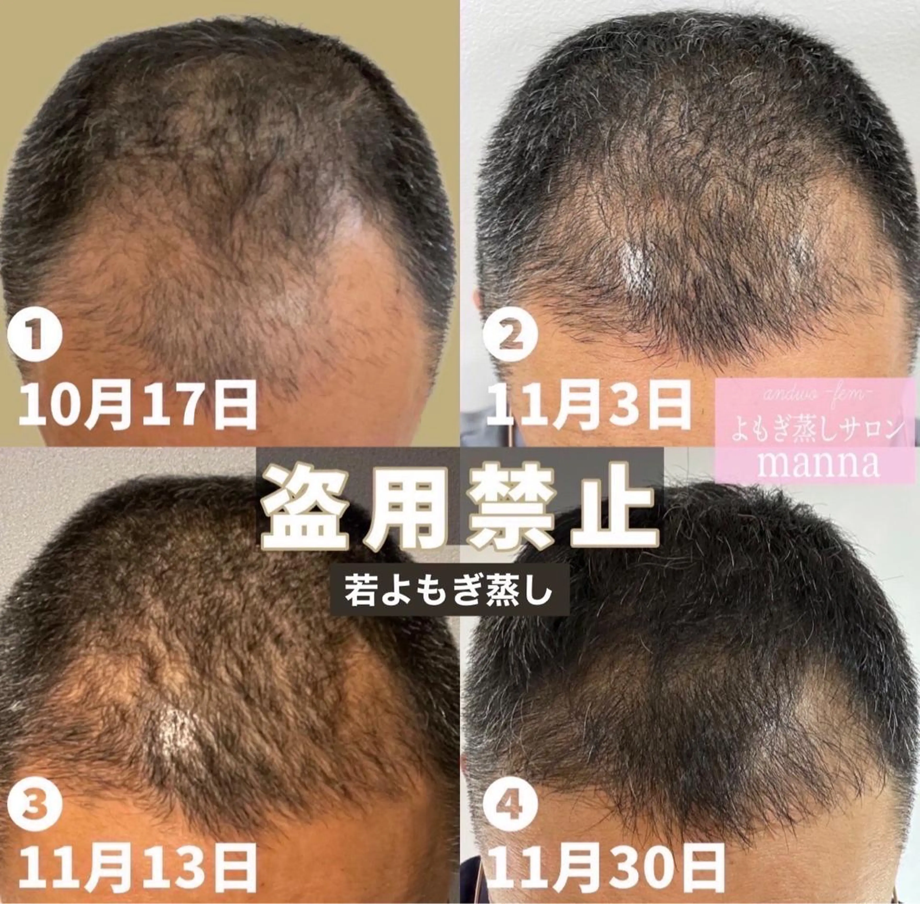 private salon Dea_maris シュガーリング&パーソナルボディケア所属・シミ改善・韓国肌管理 ボディメイク痩身のその他イメージ