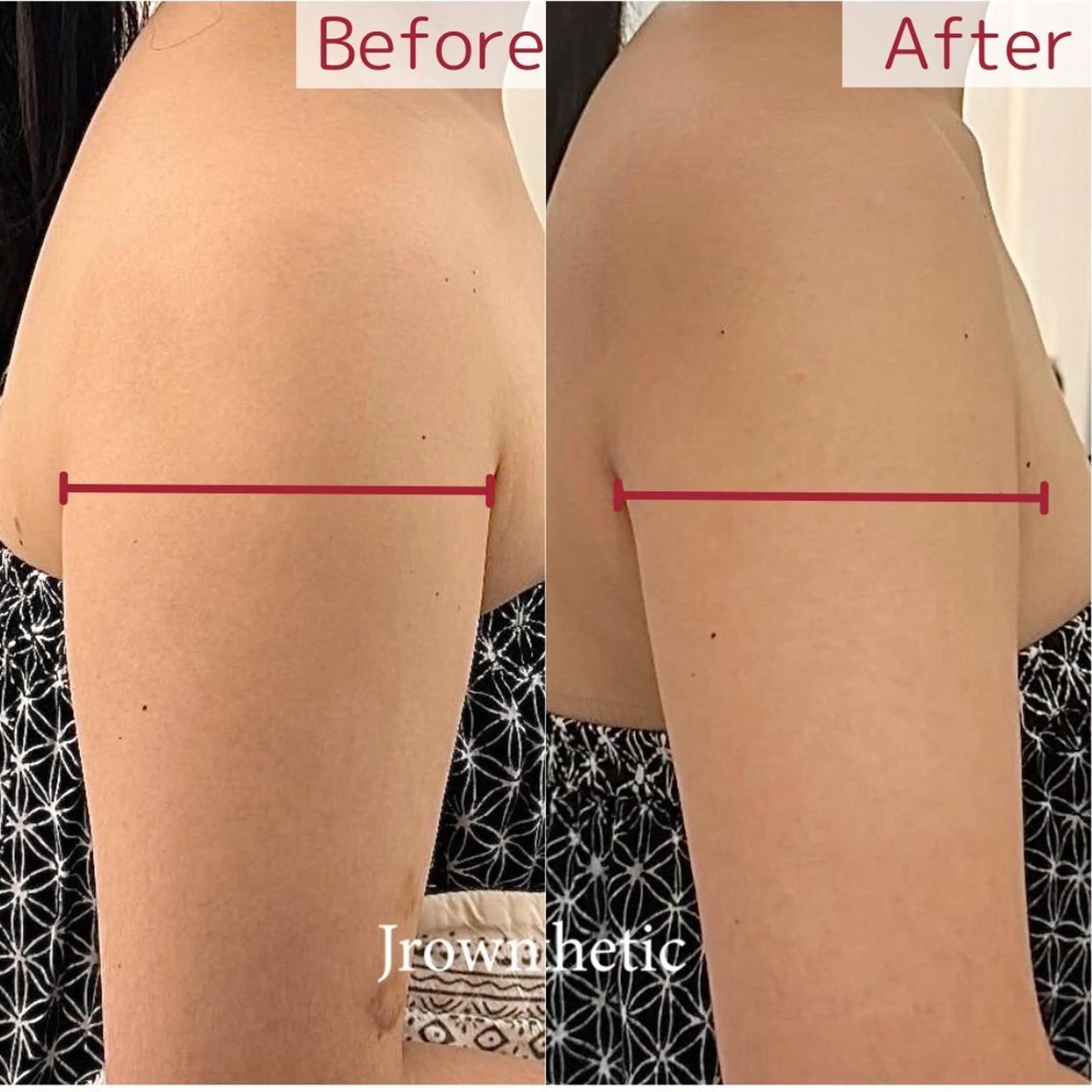 Lien オーナー 山口智嘉のエステ・リラクイメージ