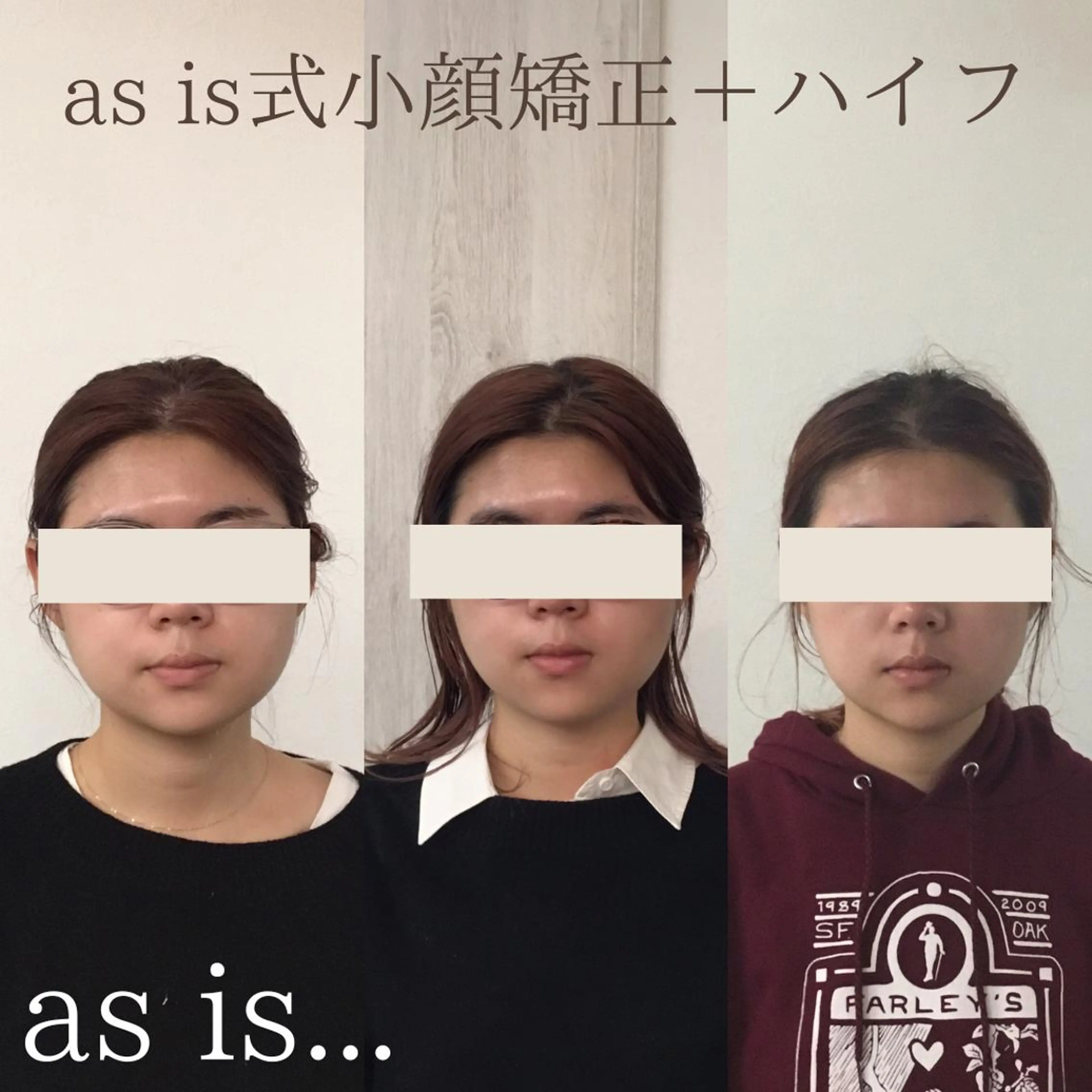 エステ 小顔専門アズイズ ビューティー　草津店のエステ・リラクイメージ