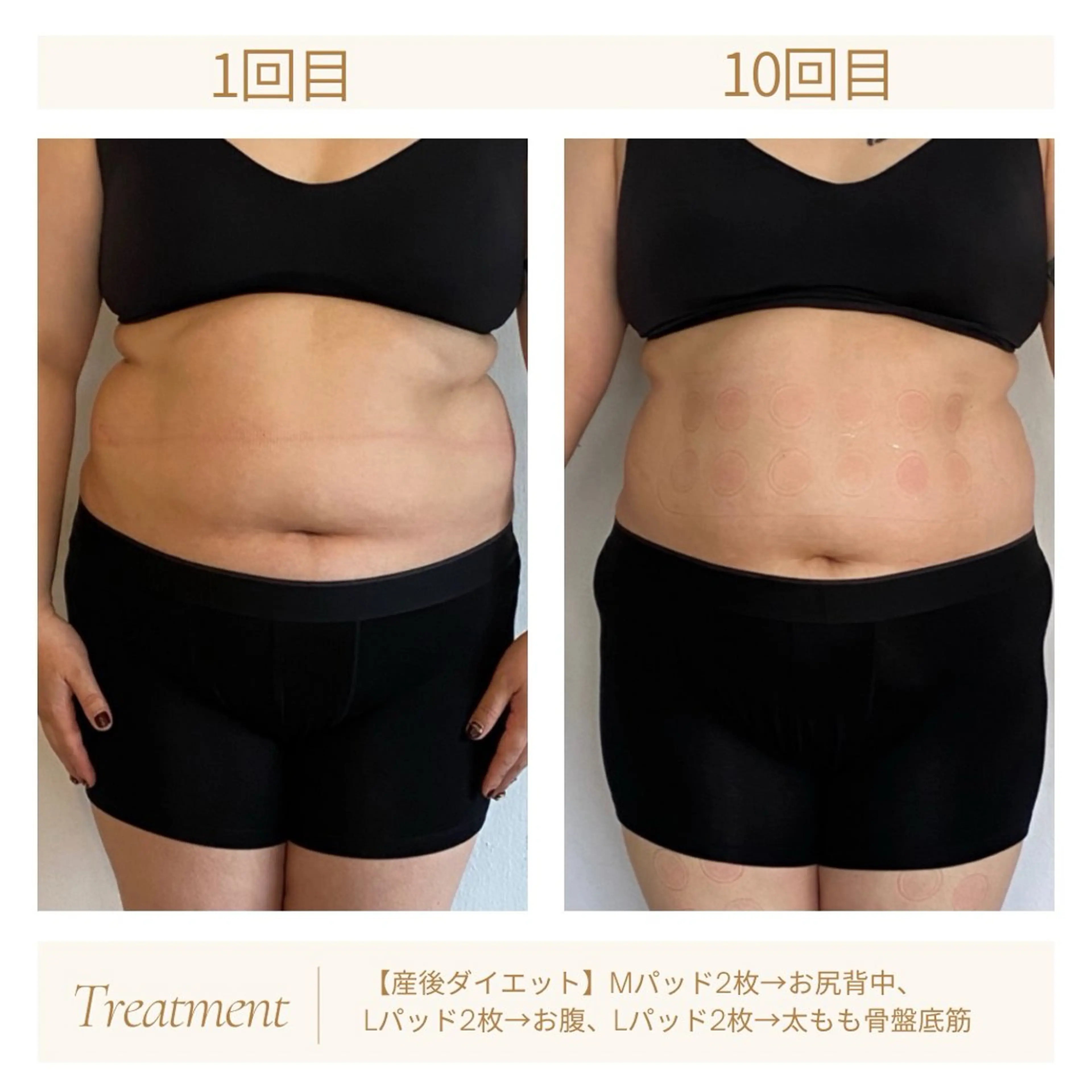 巻いて寝るだけ、脂肪アタック、そして燃焼→インナーマッスルまで鍛えて痩せる、ハイスペックマシーンTMキューブの写真