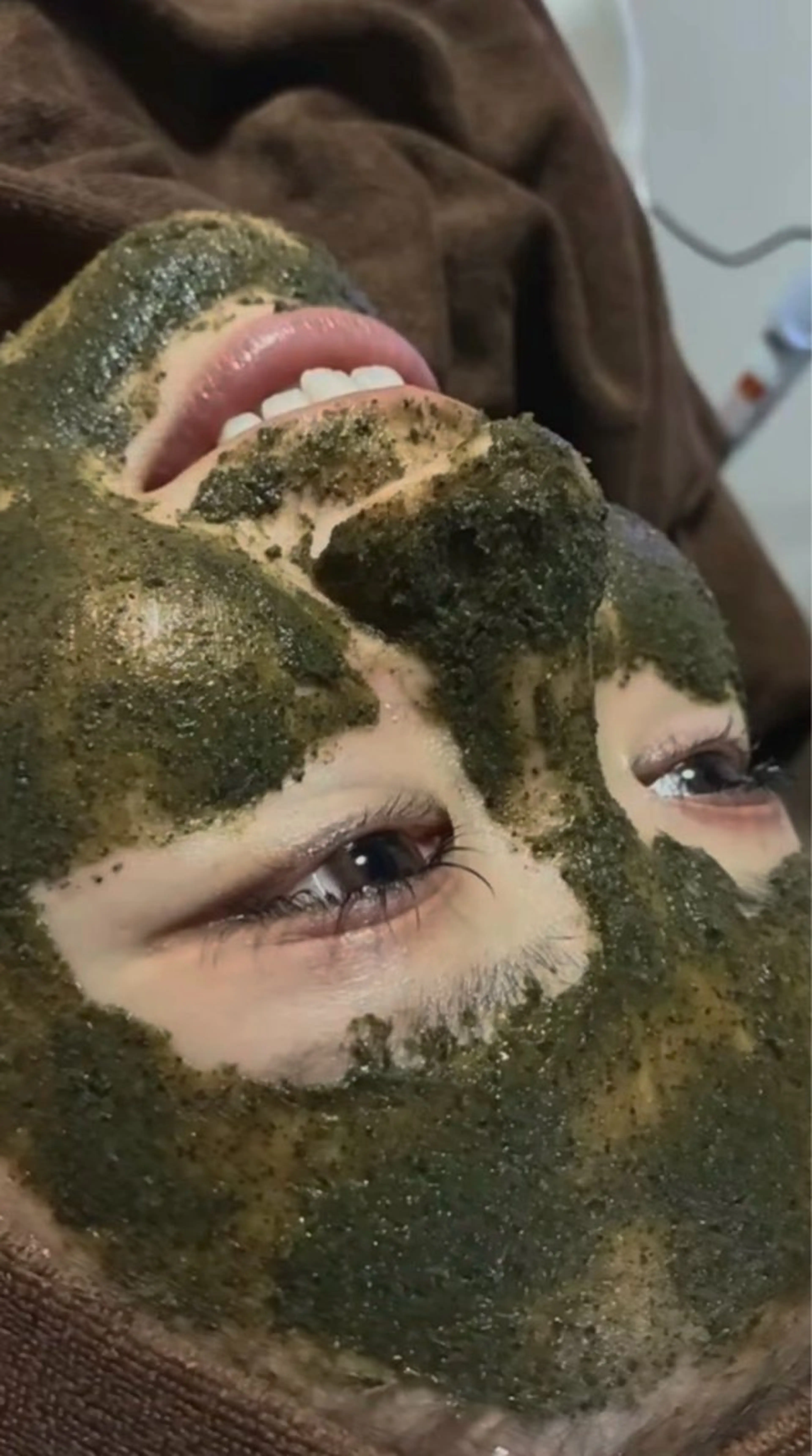 ハーブピーリング（剥離なし）の写真