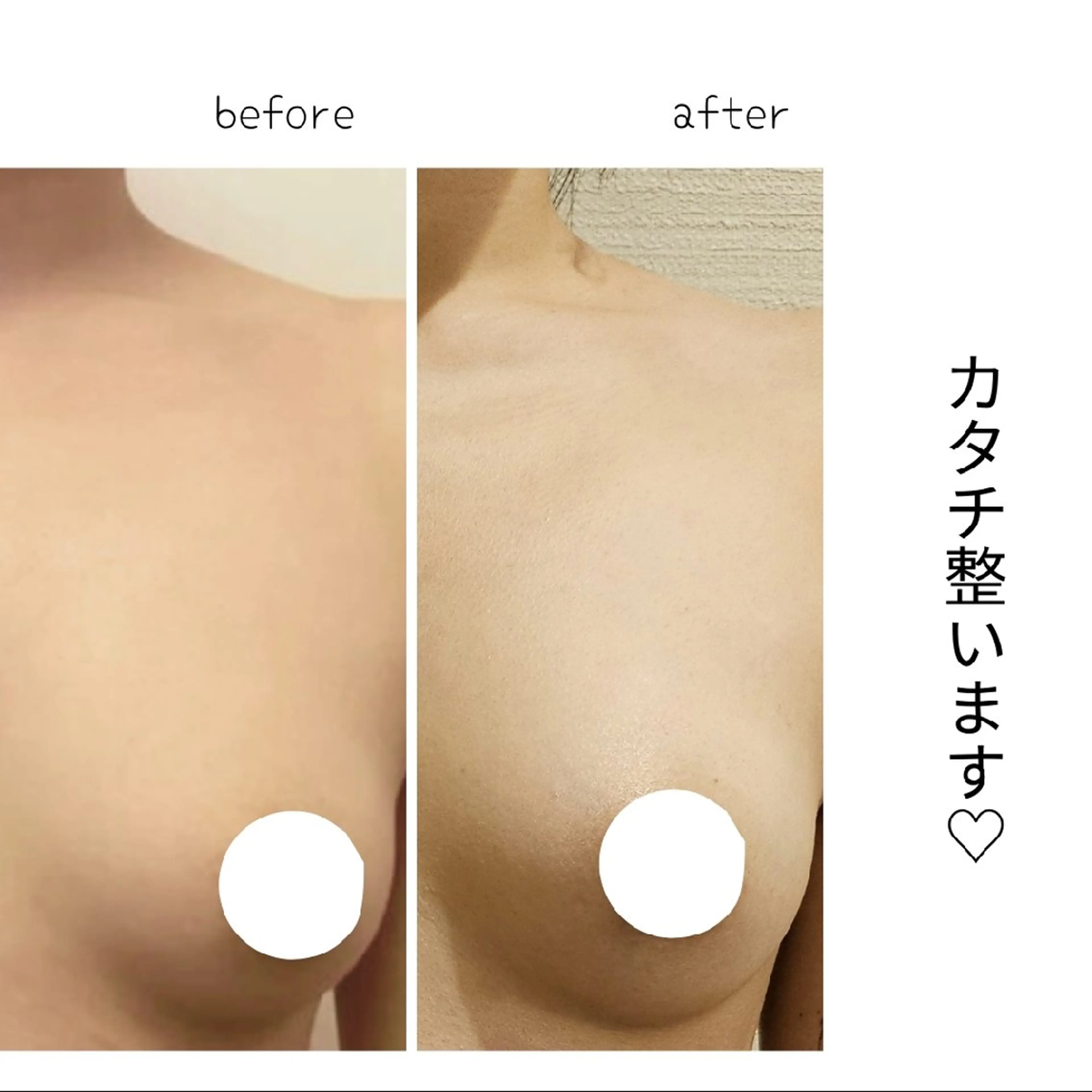 エステ リラク ブロッサム那覇店所属・自分のための筋膜 ﾘﾘｰｽ(Shey)のエステ・リラクイメージ