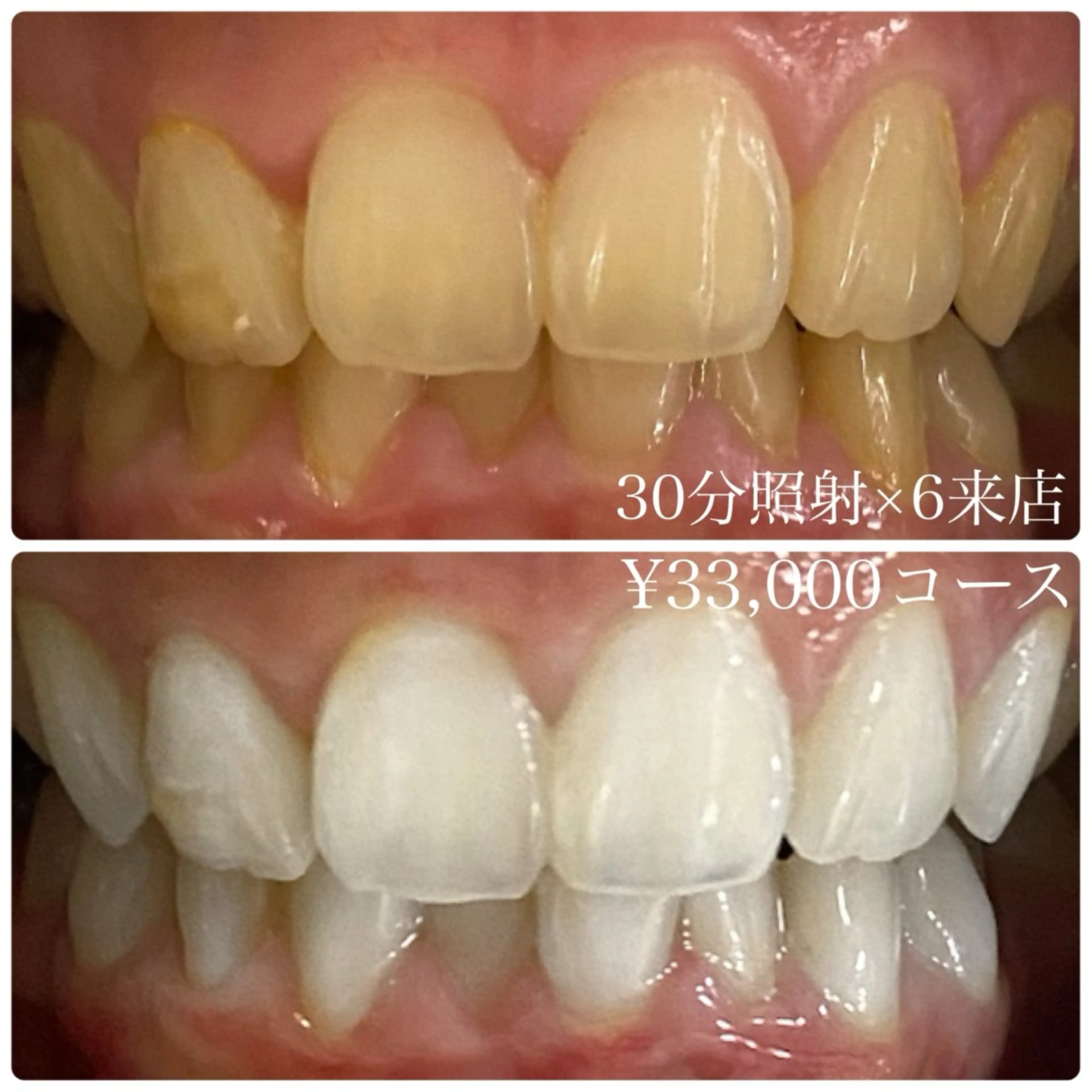 メンズ その他 ホワイトニングルーム　川崎店所属・ホワイトニング ルーム　川崎店のその他イメージ