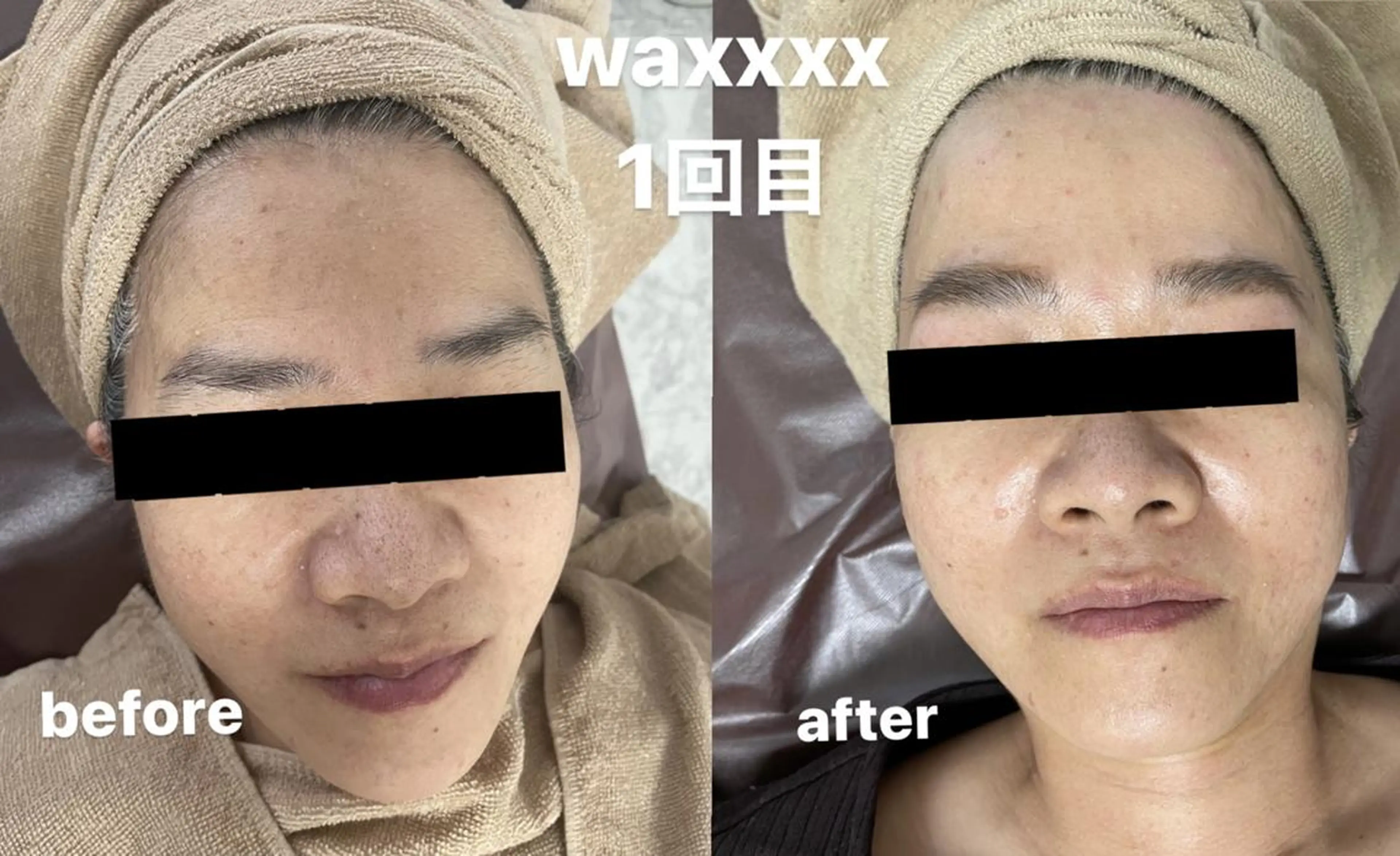 メンズ 脱毛 Epina 千葉店 【エピナ】のエステ・リラクイメージ