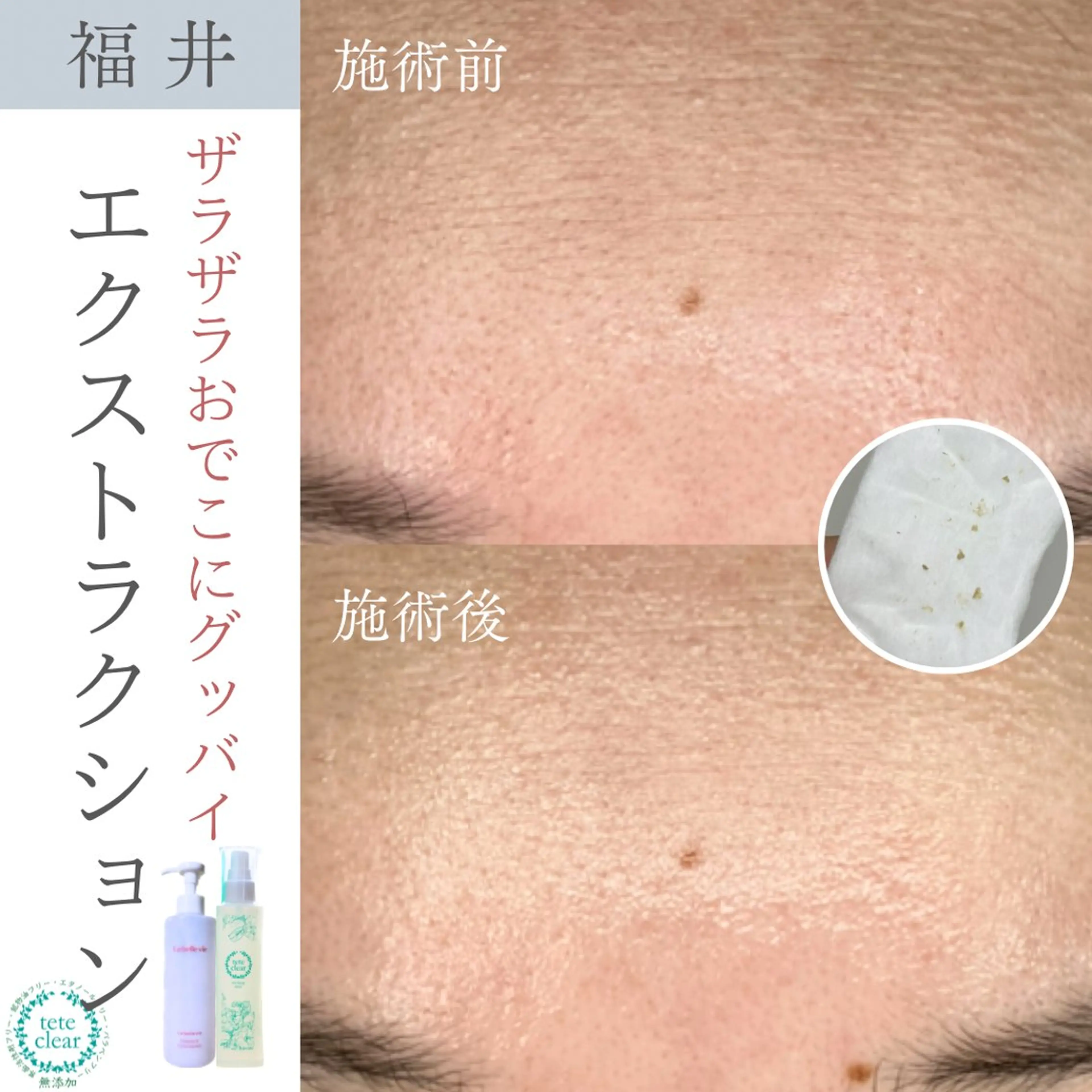 毛穴ケア専門サロン Yourmeユアミーのエステ・リラクイメージ