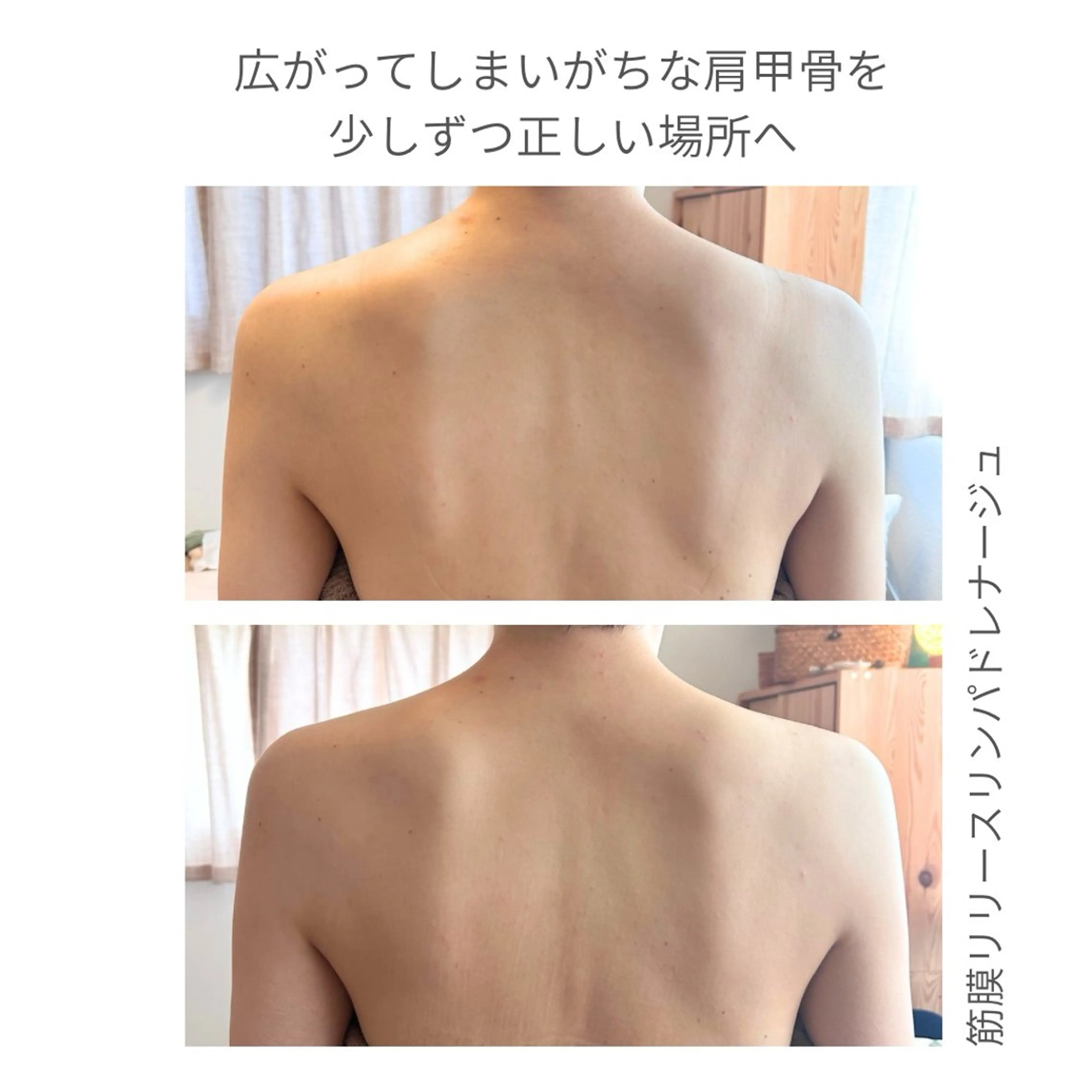 【首肩こり・巻肩】背面+デコルテ筋膜リリースリンパ60分/¥10200→の写真
