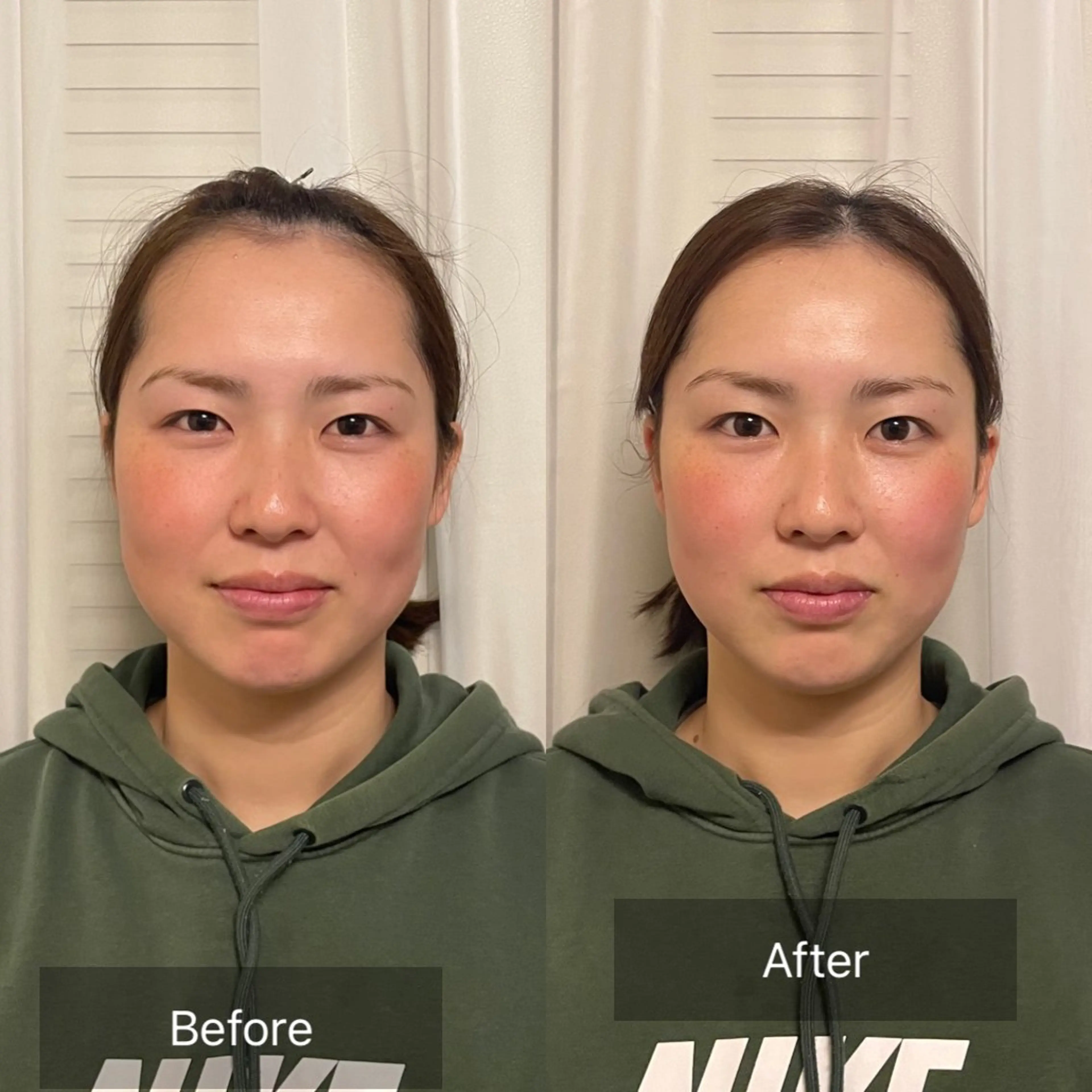 【むくみ流し×小顔整顔✨】ドライヘッド 40分の写真