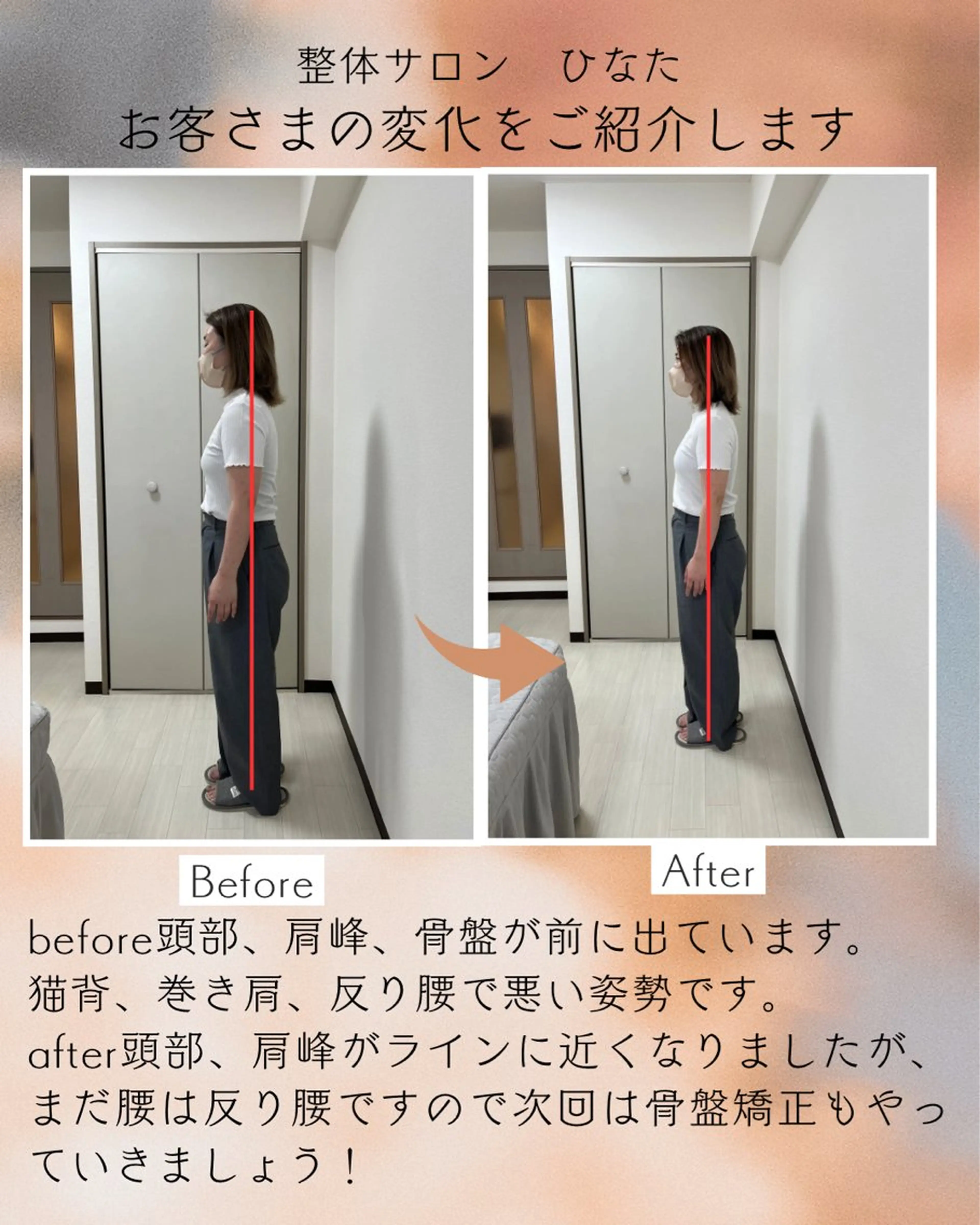 整体サロン　ひなた~HINATA~ 　京阪七条　京都店所属・肩こり反り腰改善専門 筋膜✨整体ひなたのエステ・リラクイメージ