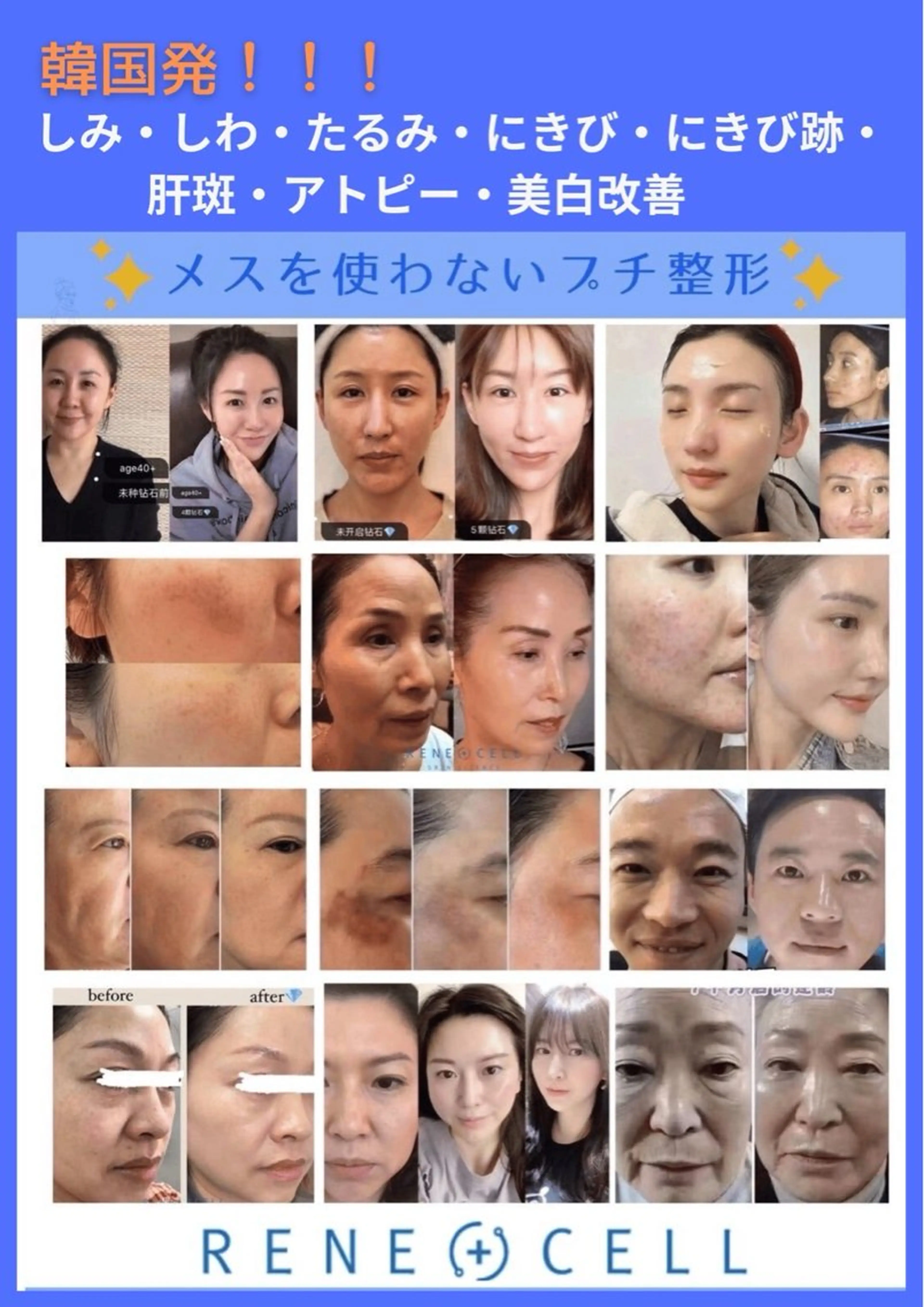 【韓国化粧品ルネセル】ダイヤモンドピール💎肌再生/肌年齢巻き戻し/ファンデーションレスになれる/あらゆる肌トラブル改善の写真