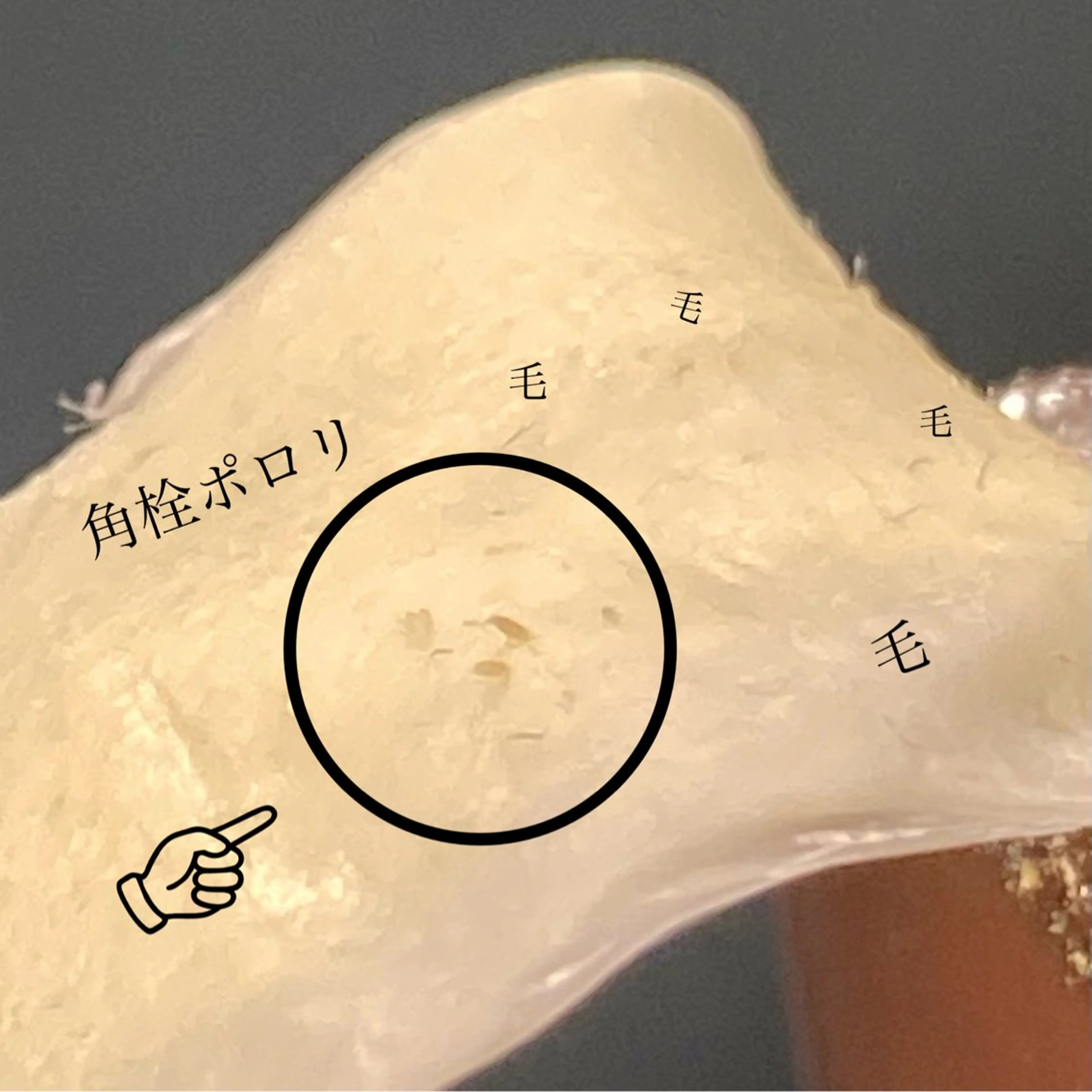 脱毛 &me ayakaのエステ・リラクイメージ
