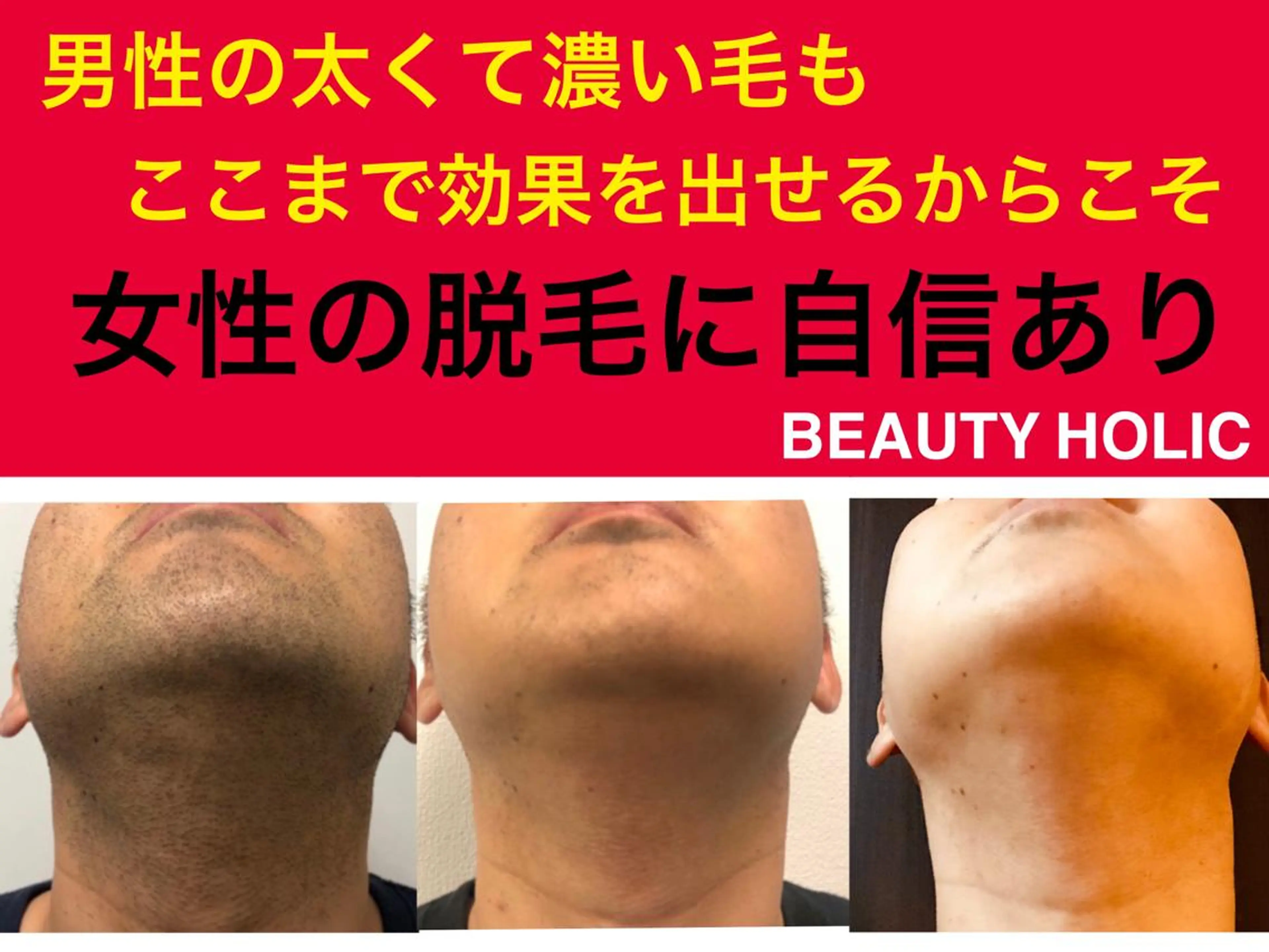 ニキビ・ 肌荒れ専門店のエステ・リラクイメージ