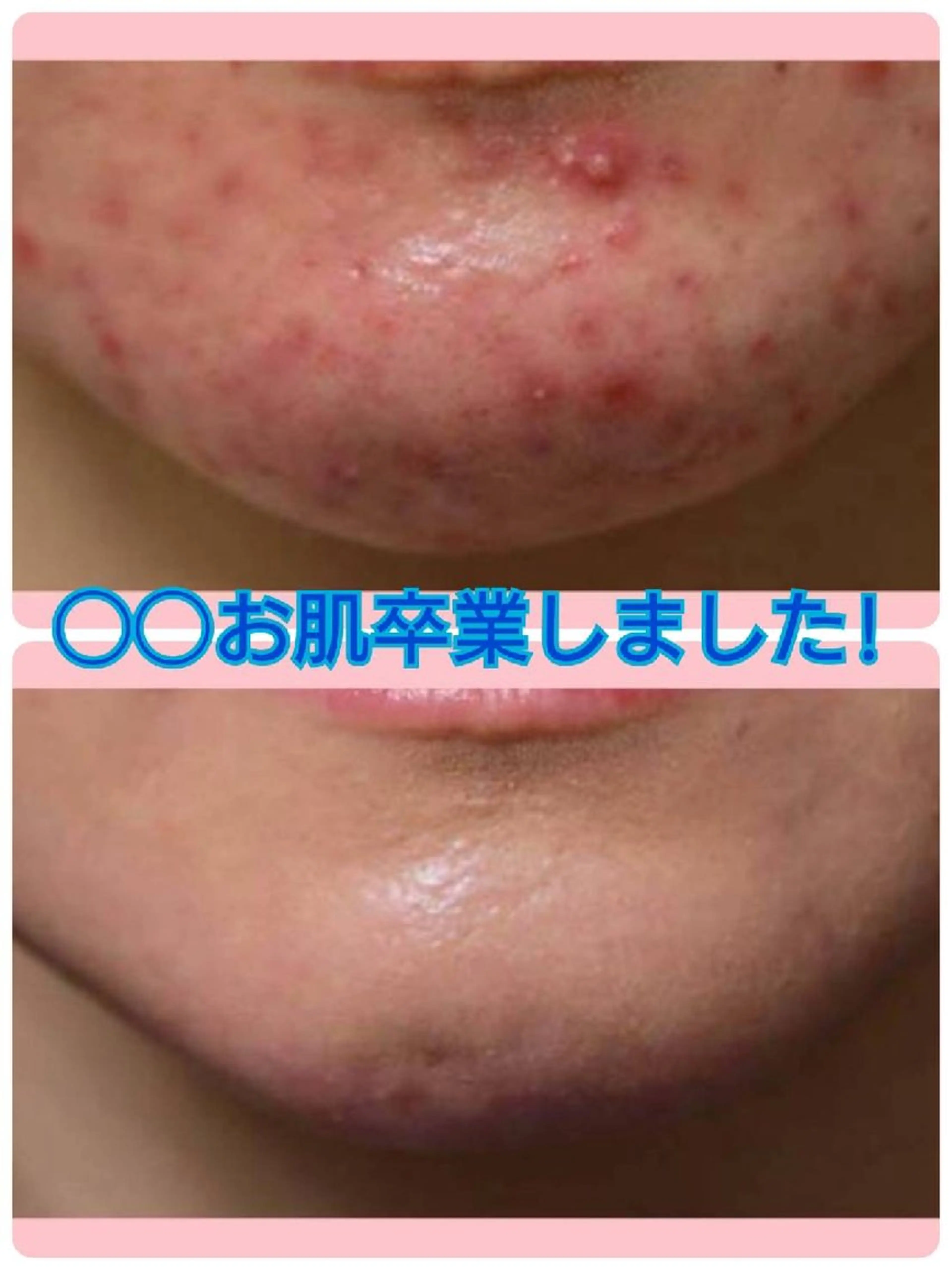 エステ ハーブピーリング 専門店Kikkaのエステ・リラクイメージ