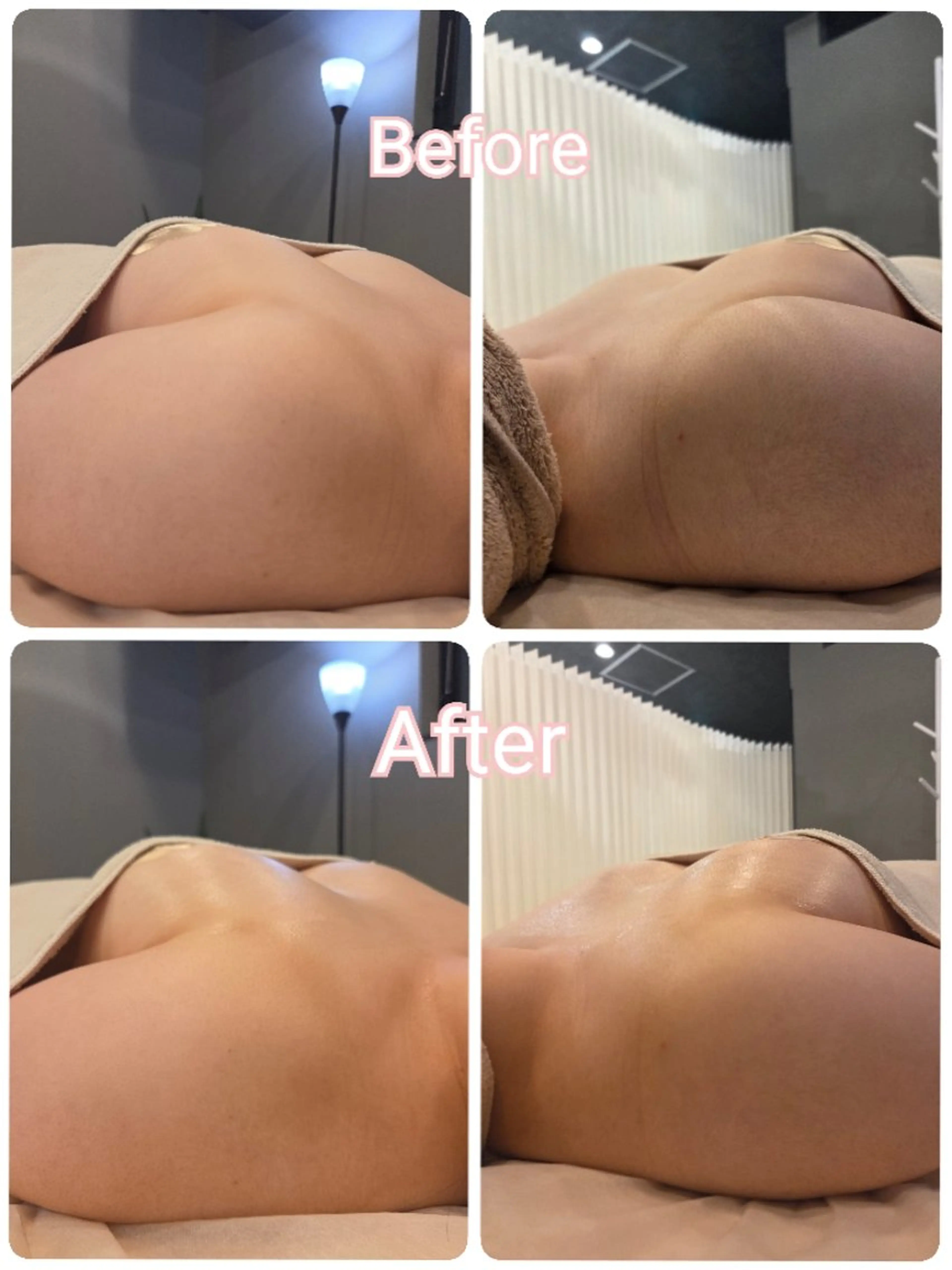 バストケア 60分  美容液導入込の写真