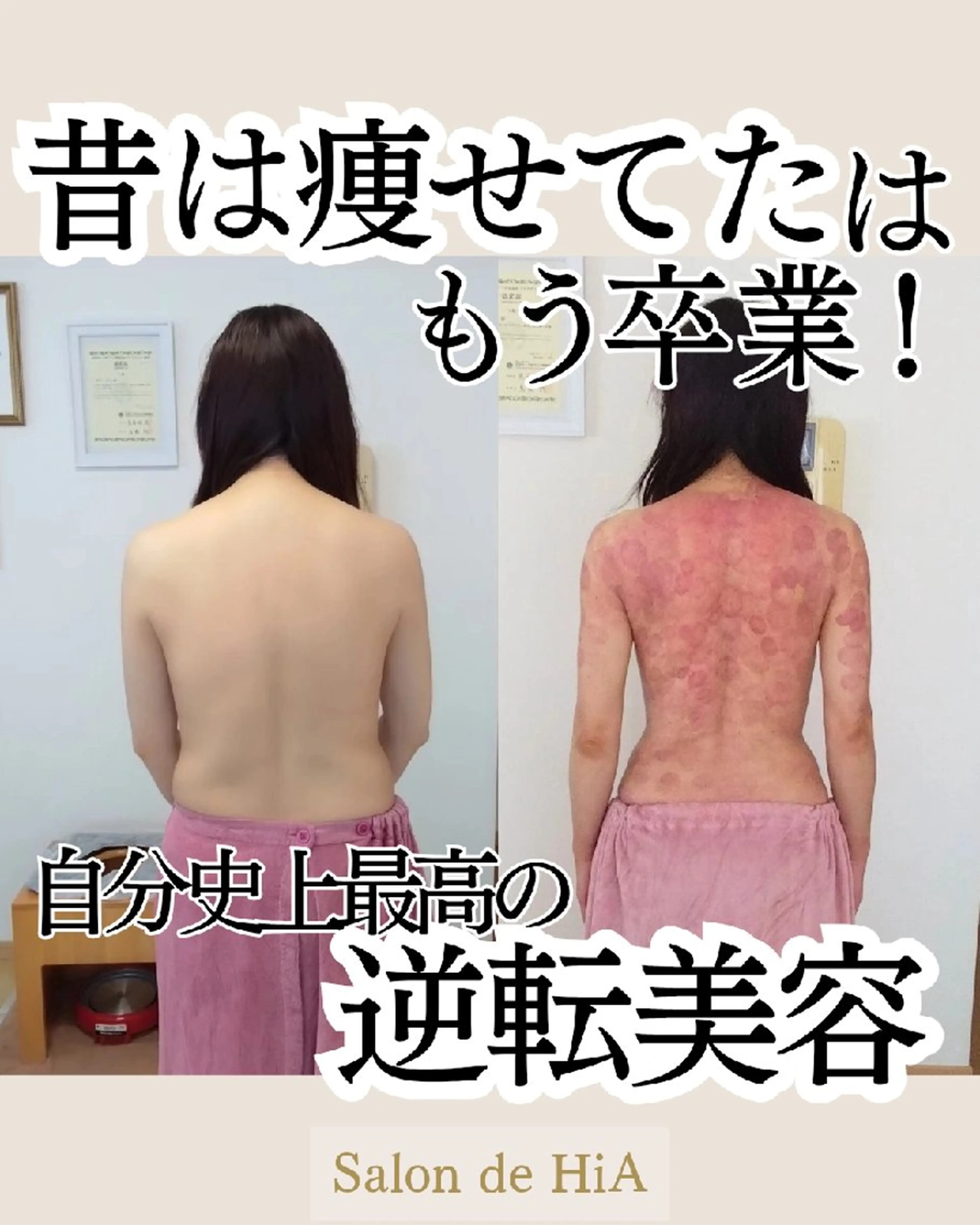 エステ リラク Salon de  HiAのエステ・リラクイメージ