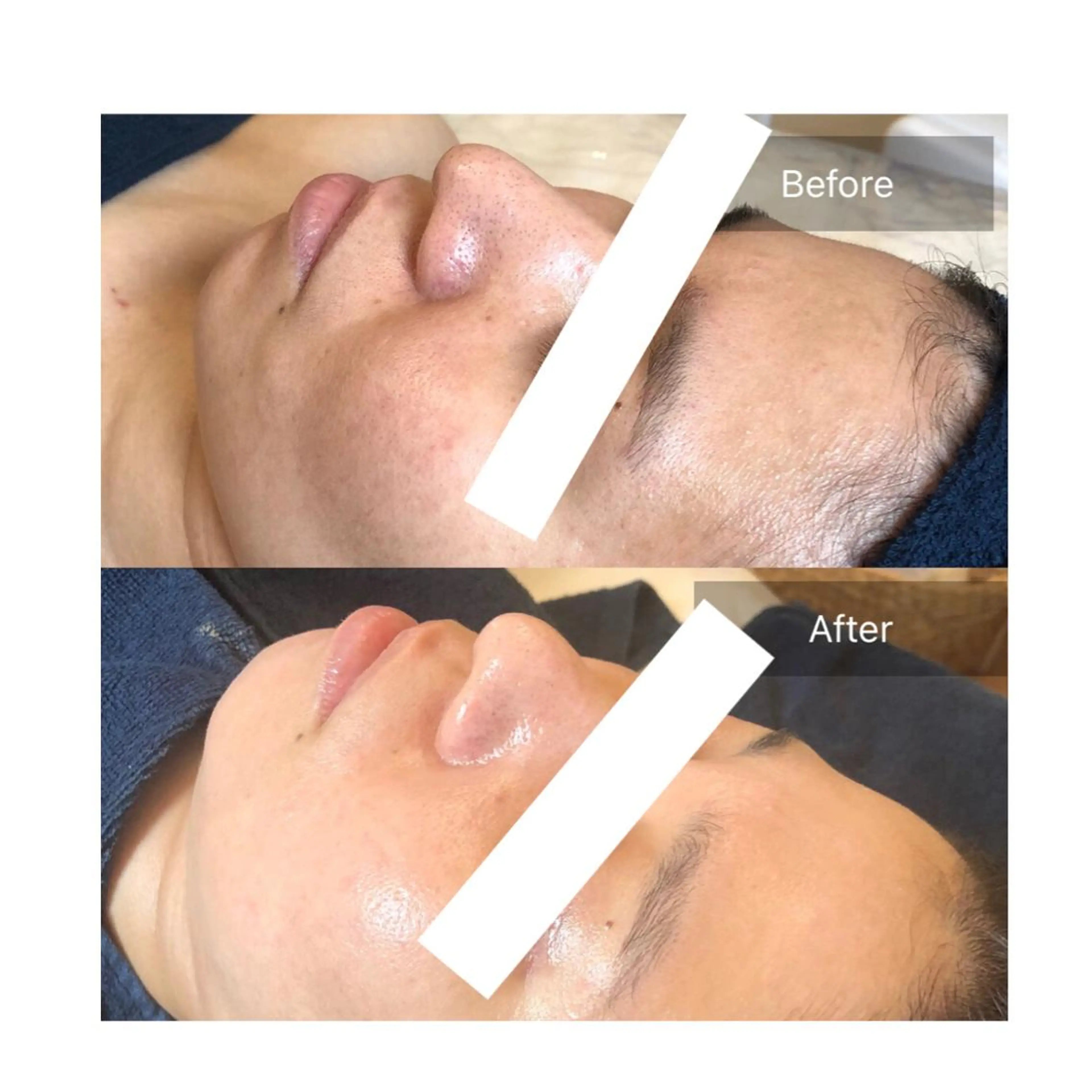 Fleur beauty salon所属・Fleur 児玉聖子のエステ・リラクイメージ