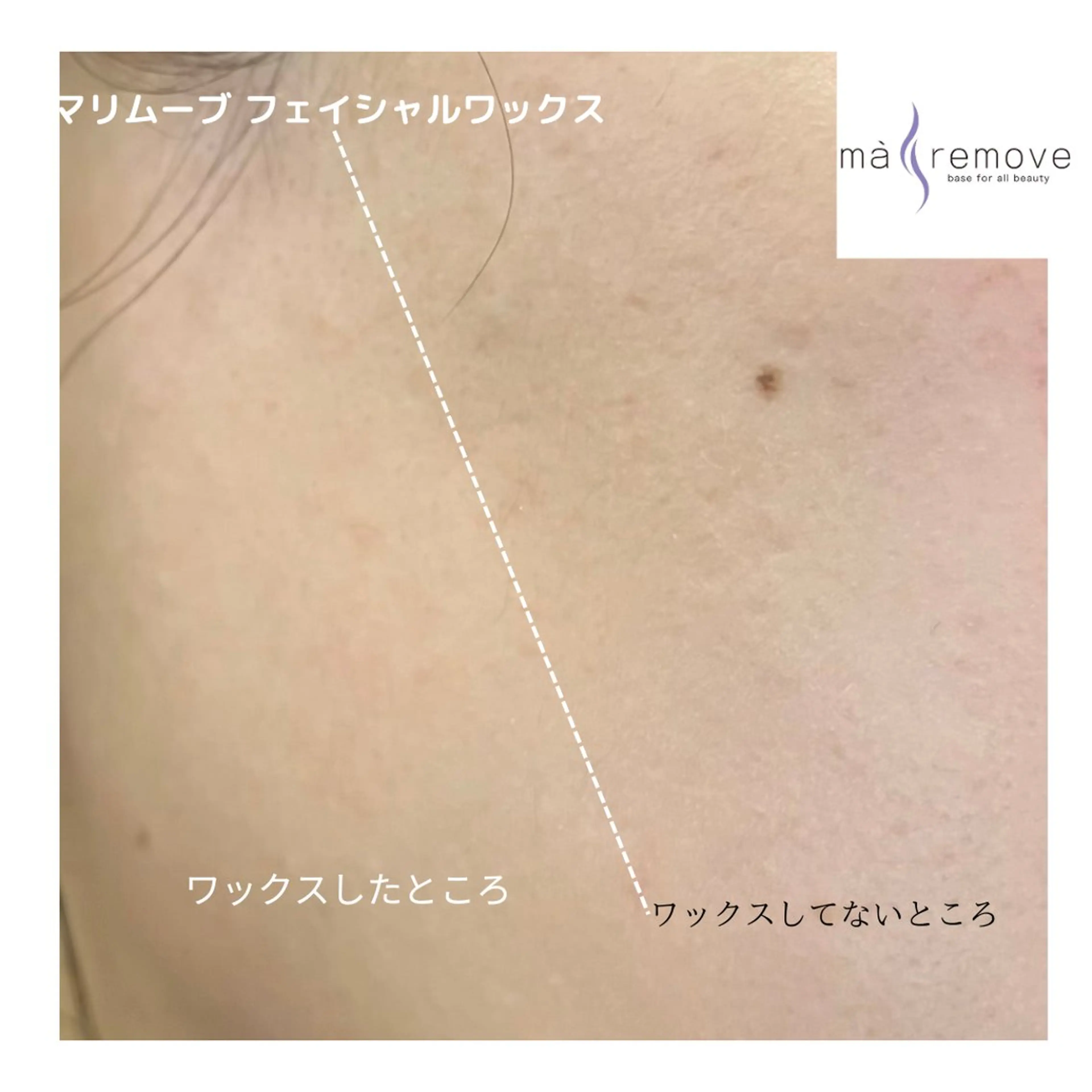 脱毛 mof.(モフ) Horieのその他イメージ