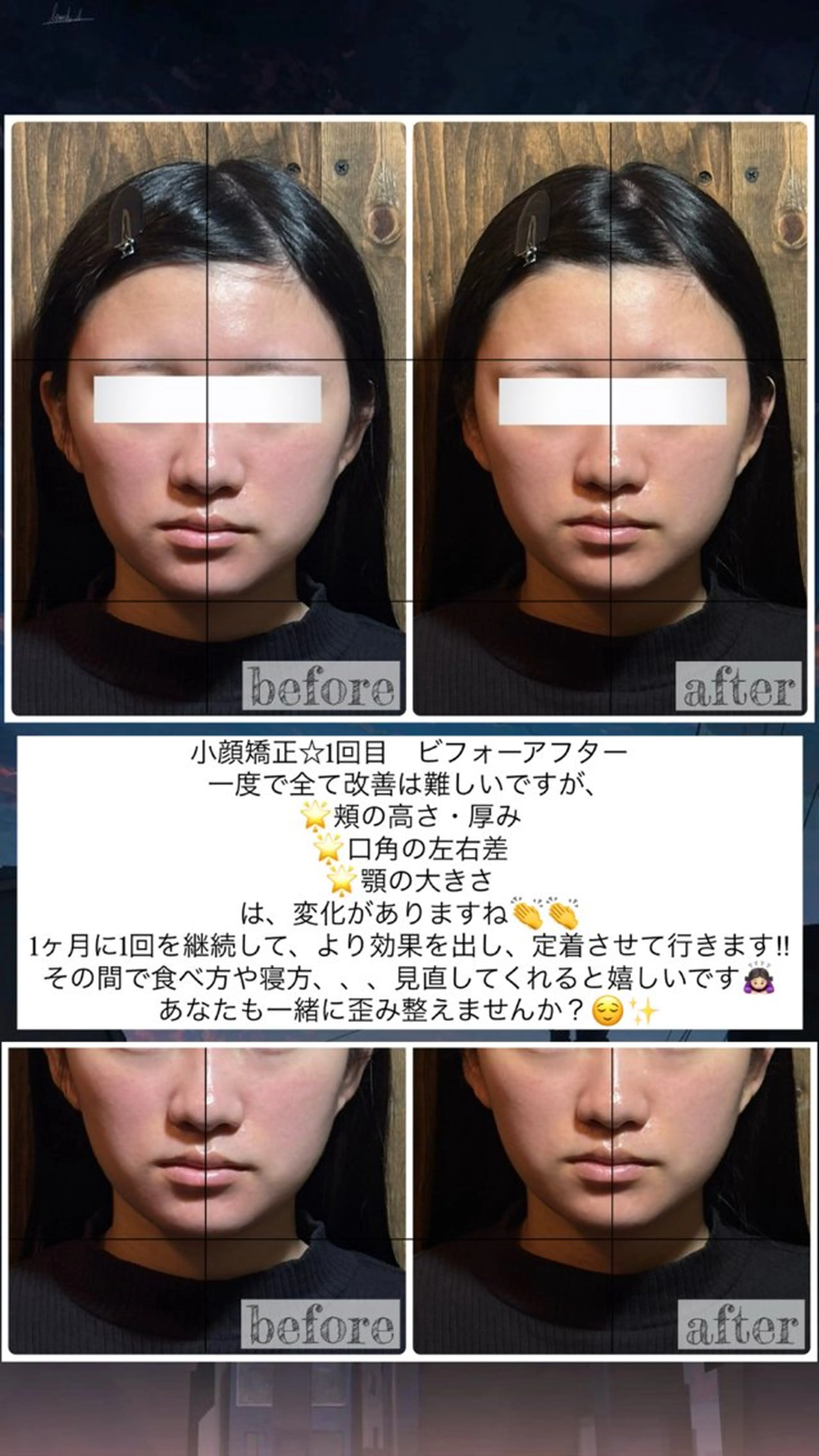 エステ リラク 💎後悔させない小顔 矯正💎イトヤマ🌱のエステ・リラクイメージ