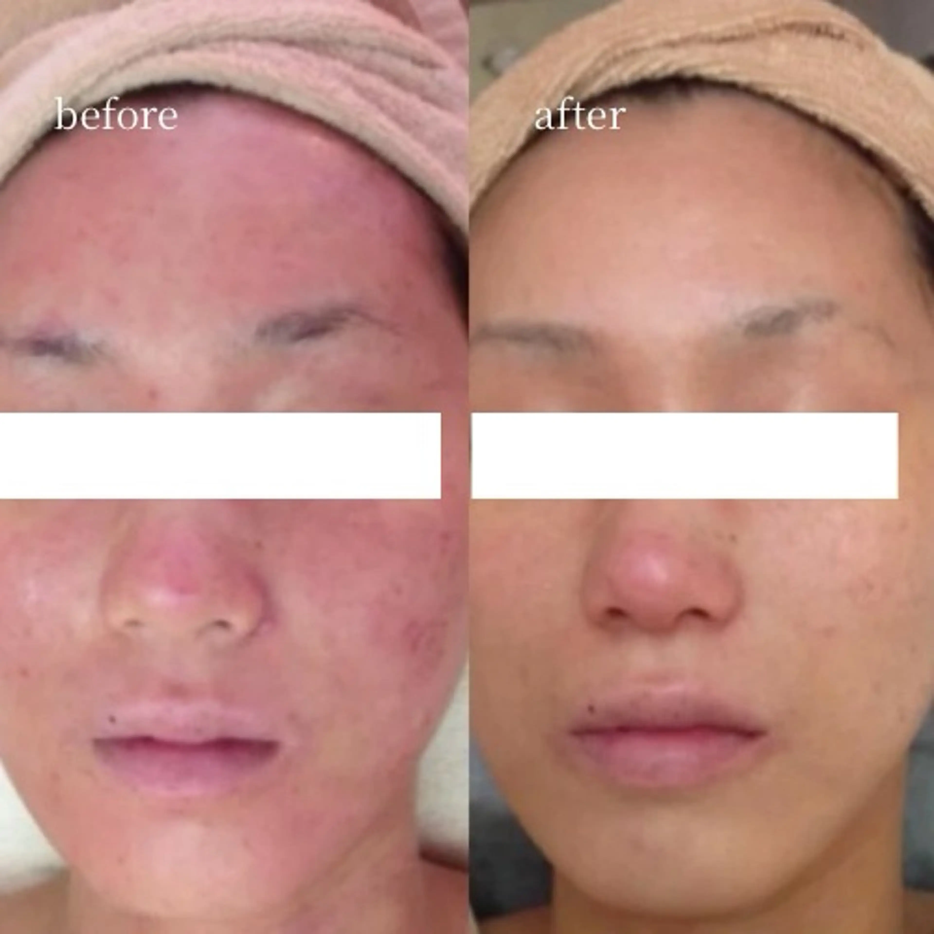 エステ 【韓国人肌製作所】 水光肌ならアーネストのエステ・リラクイメージ