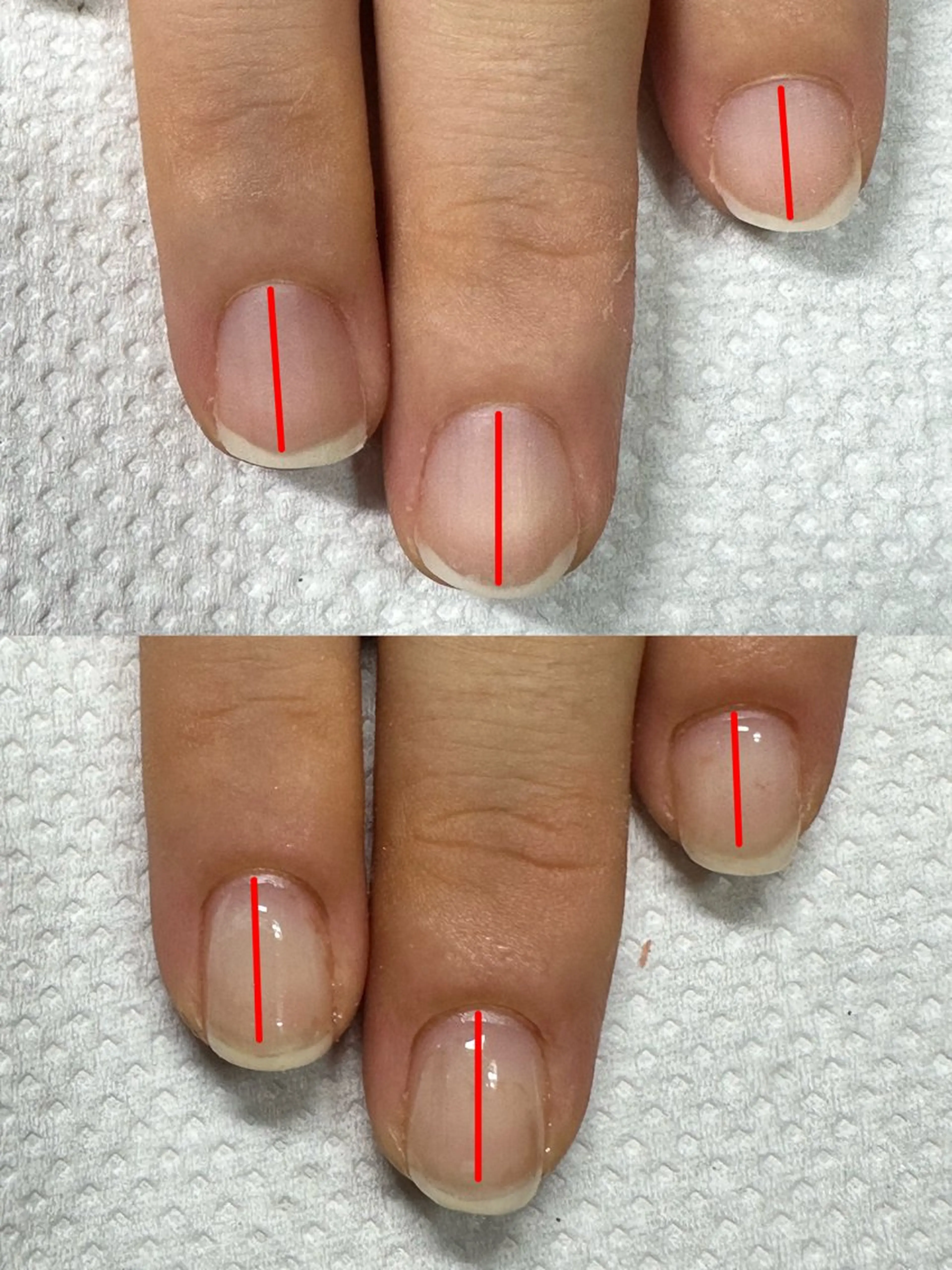 ネイル クリアネイル ジェルネイル パラジェル ネイルケアサロン Campanulaのネイルデザイン