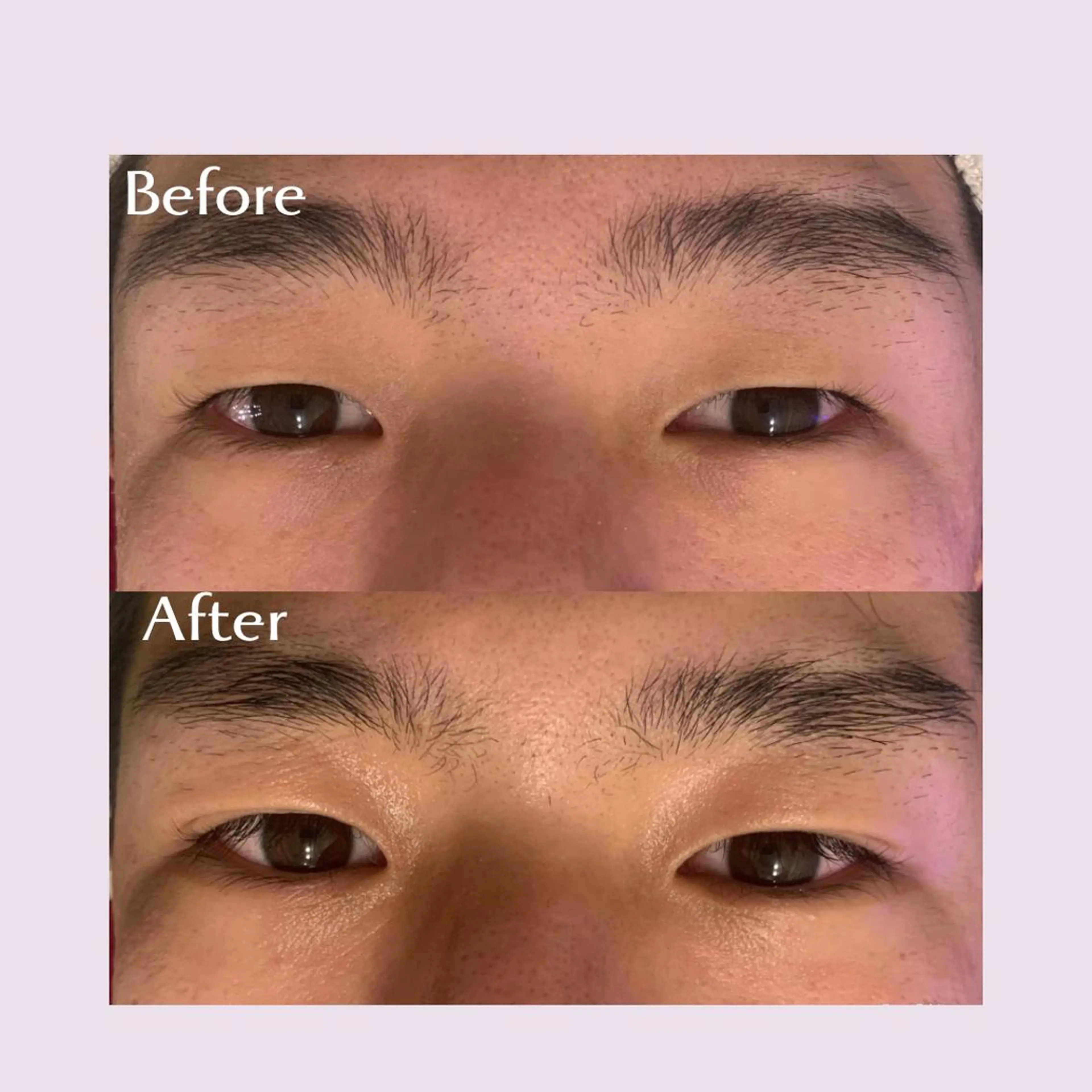 韓国肌管理ララピール クリスタルビューティのエステ・リラクイメージ