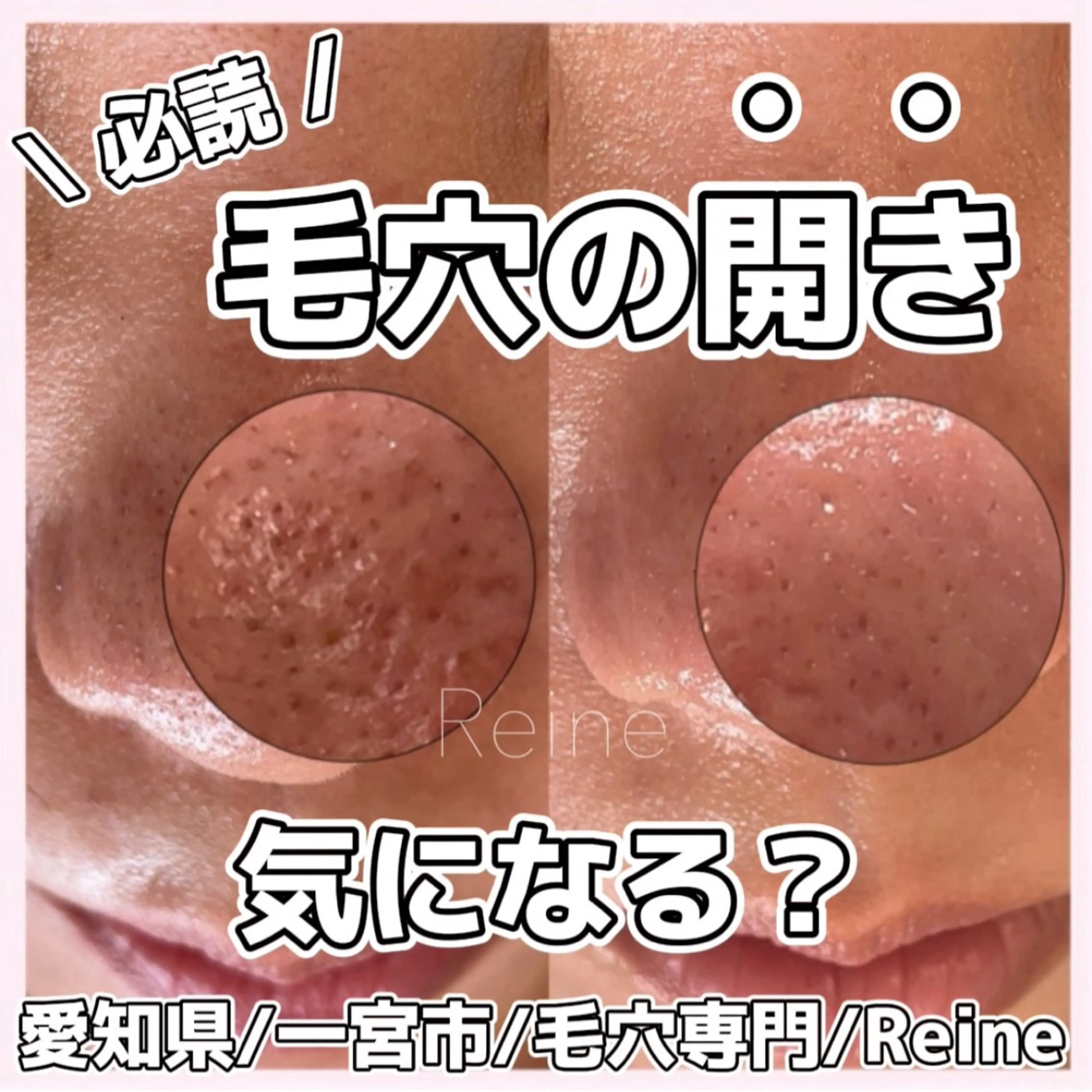 エステ Reine BeautySalon所属・毛穴/シミ肝斑/脱毛 横山梨里のエステ・リラクイメージ
