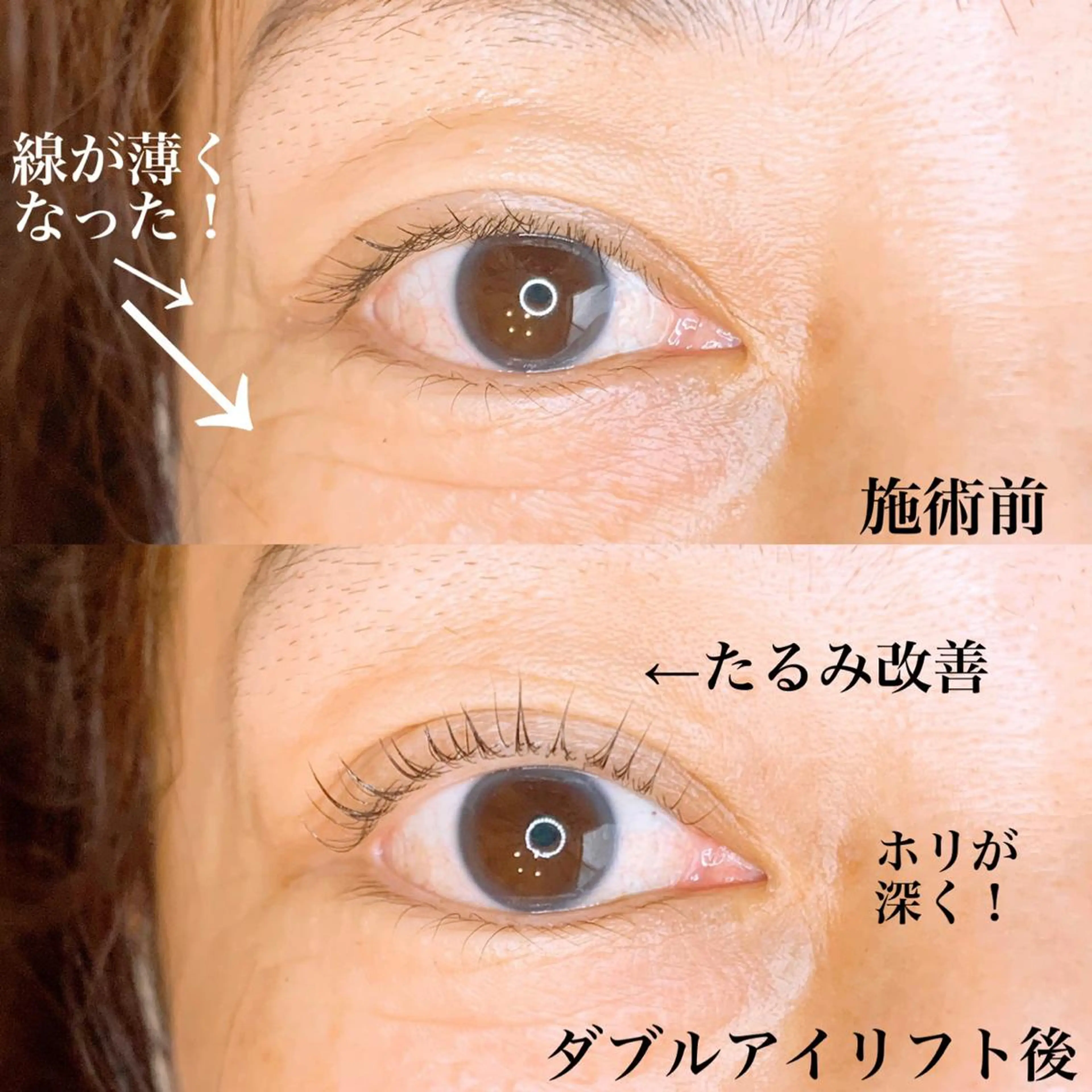 パーマ メンズ マツエク・マツパ マツパ アイラッシュサロン CoCoのエステ・リラクイメージ