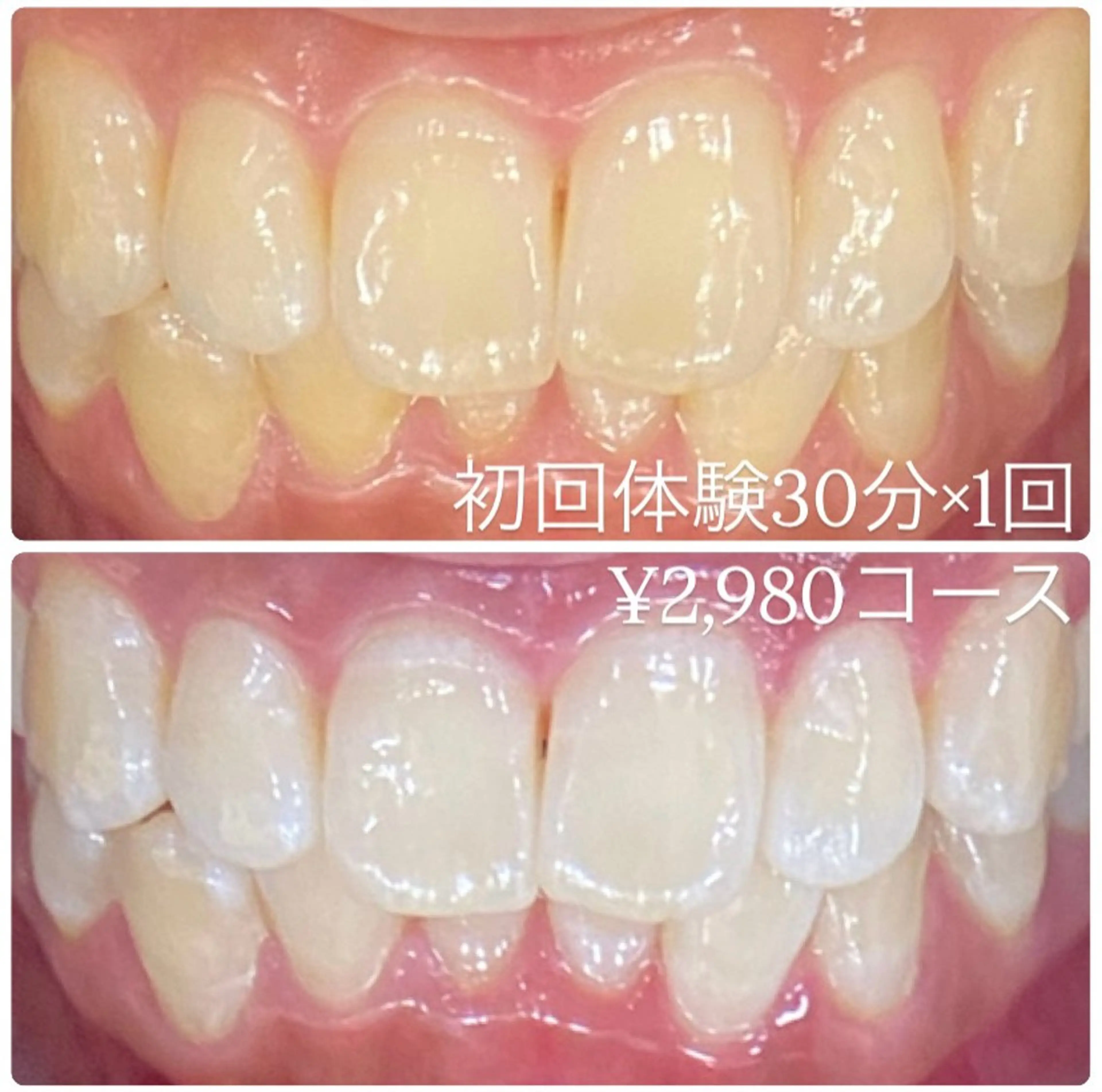 PLATINUM Beauty 横浜店所属・ホワイトニングルーム 横浜店のその他イメージ