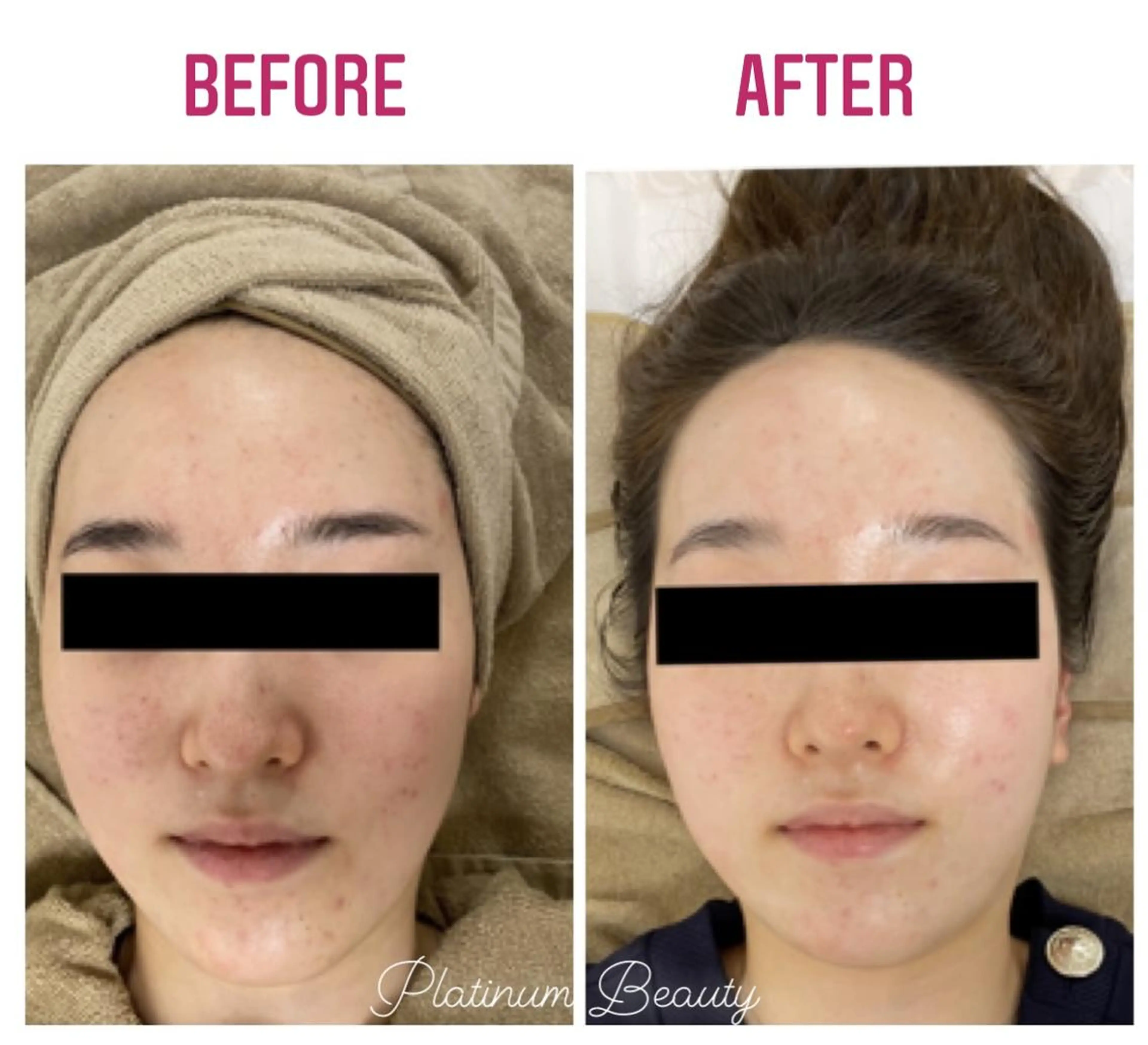 エステ プラティーヌ ボーテ【もものり】のその他イメージ