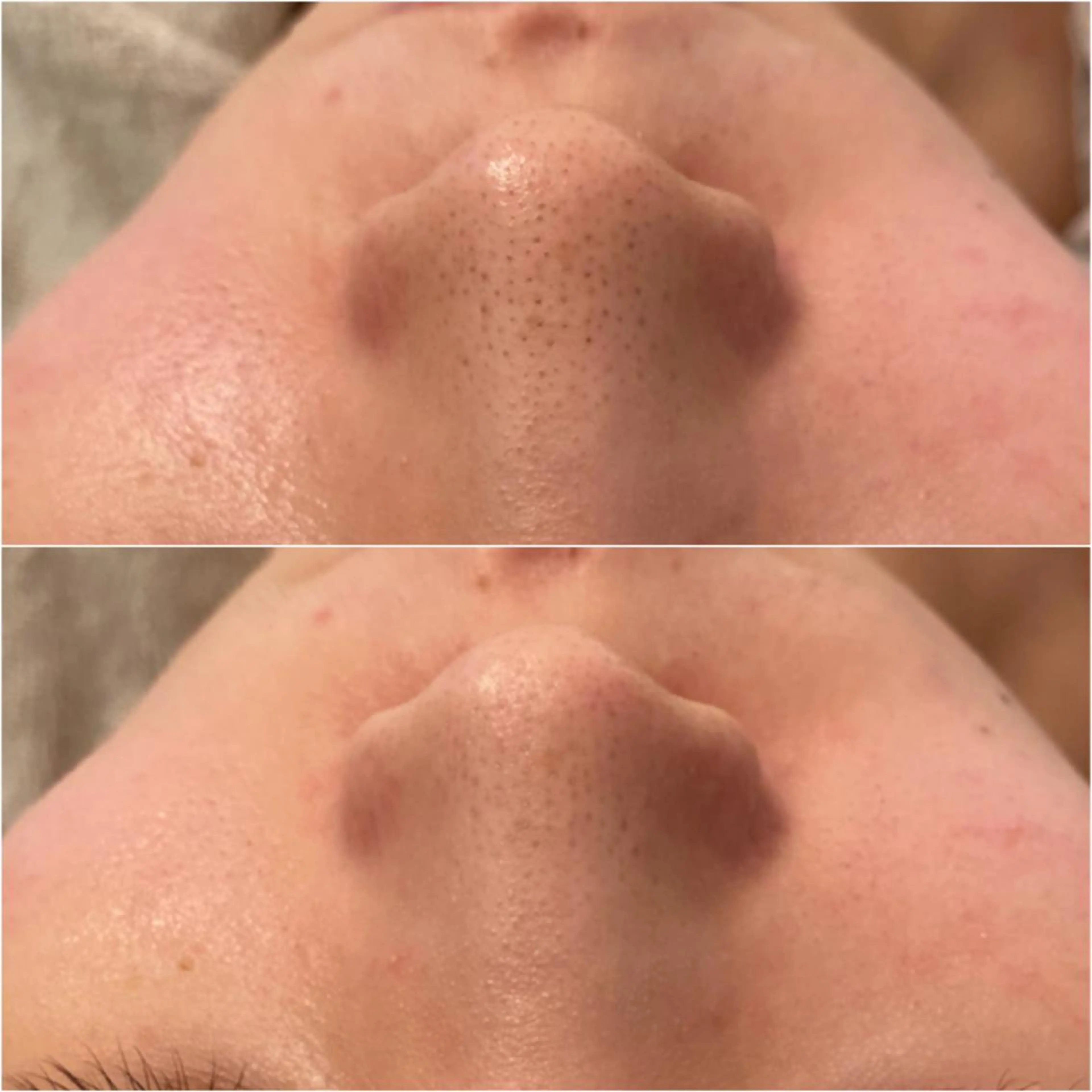 エステ ✨美肌水光✨ アトリエリュバンのエステ・リラクイメージ